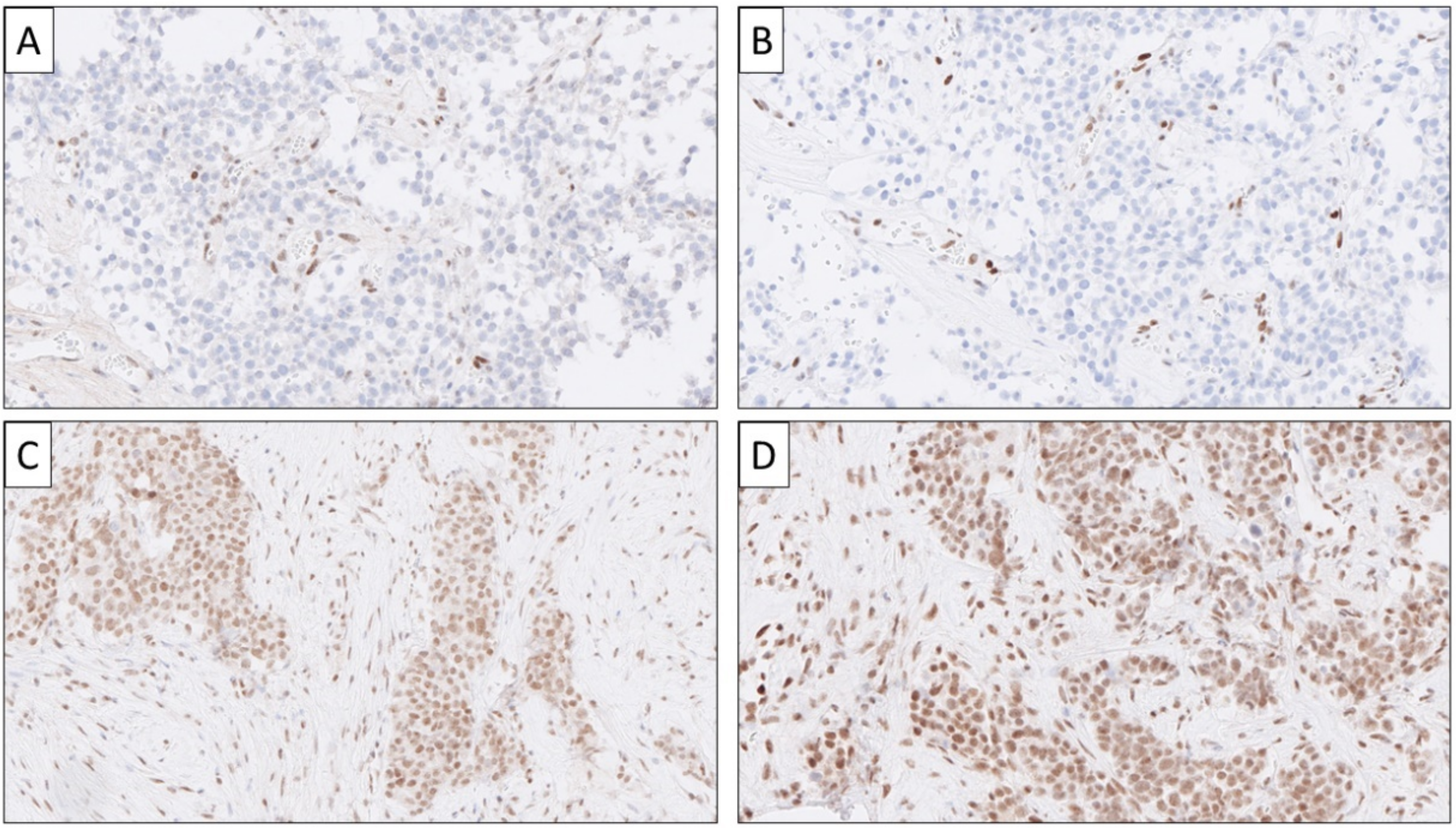 Cancers 14 02210 g007