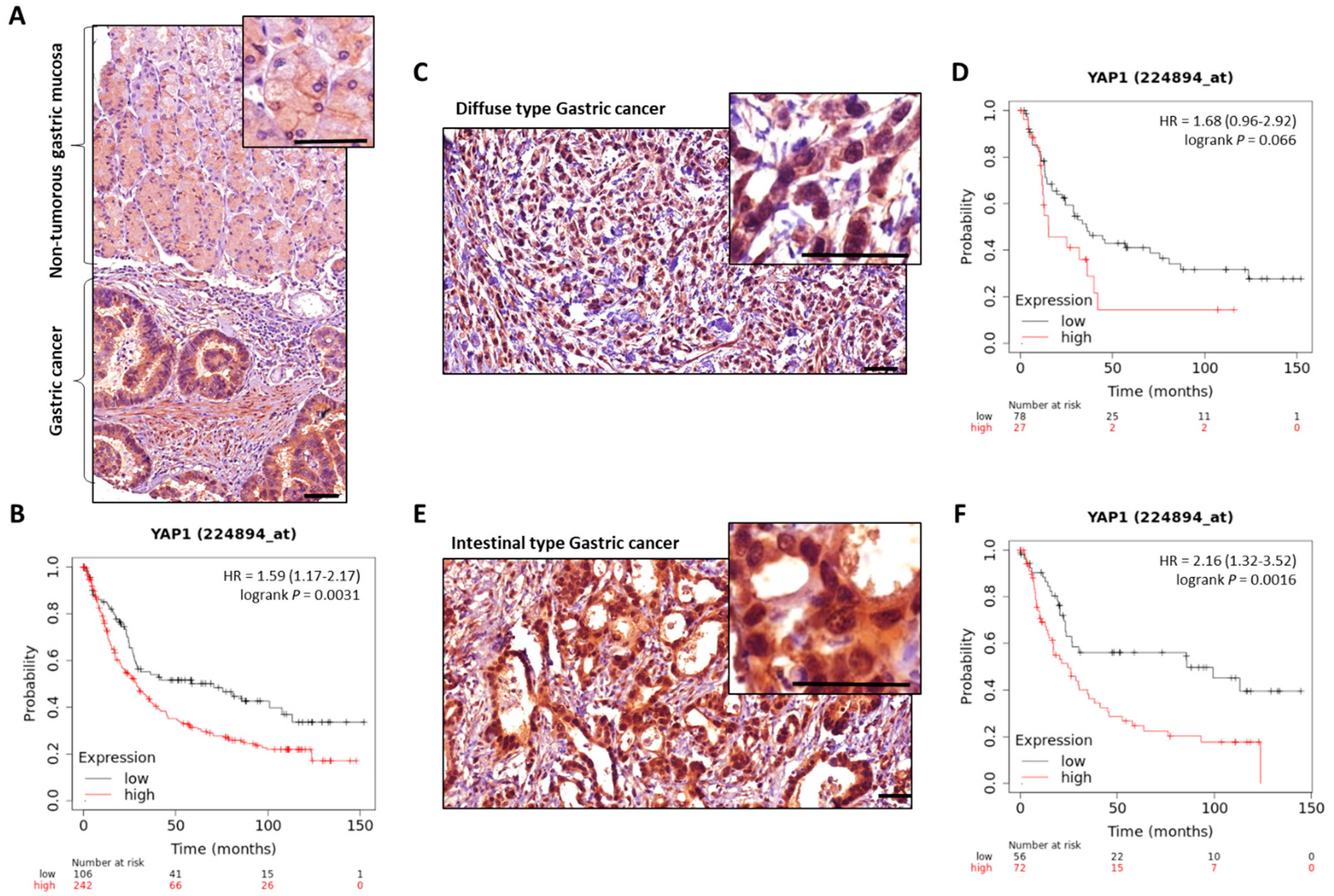 Cancers 14 02282 g003