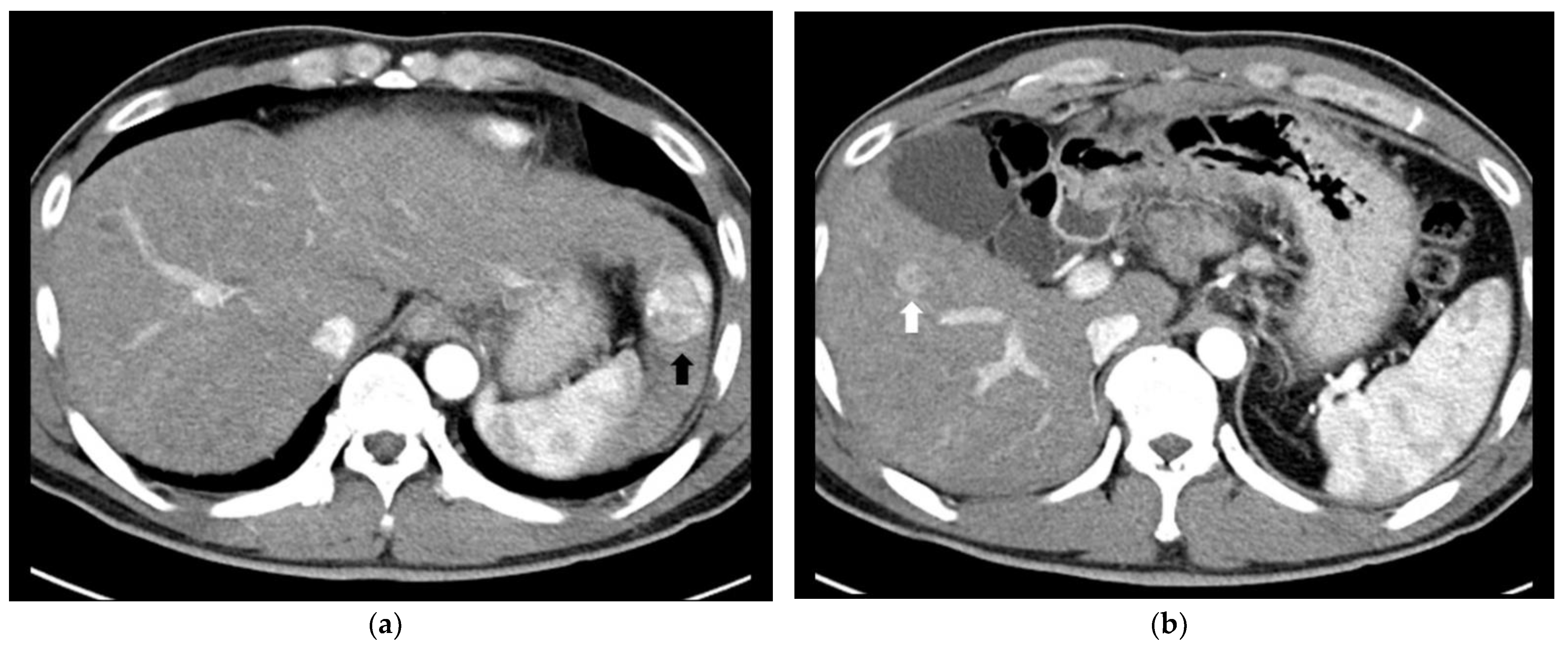 Cancers 14 02440 g003a