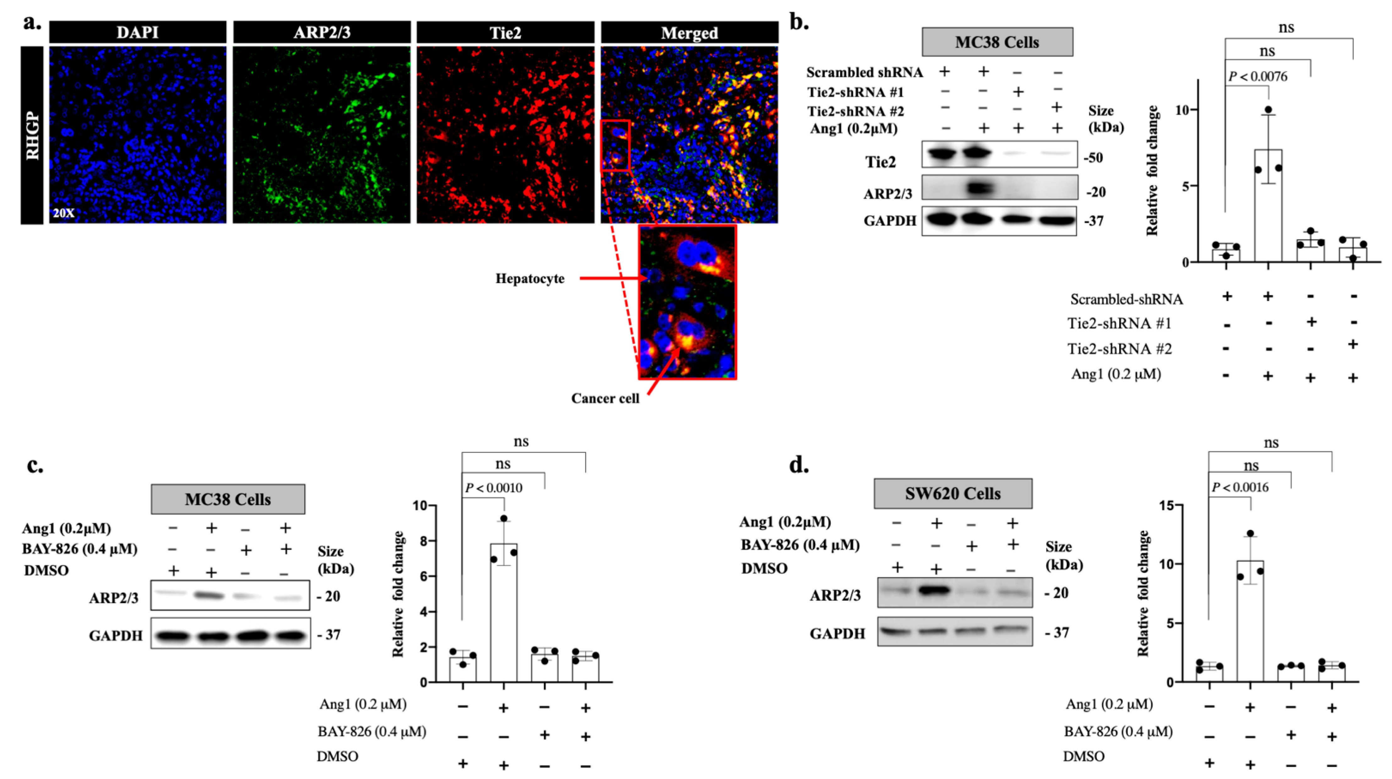 Cancers 14 02540 g004 Cancers 14 02540 g004