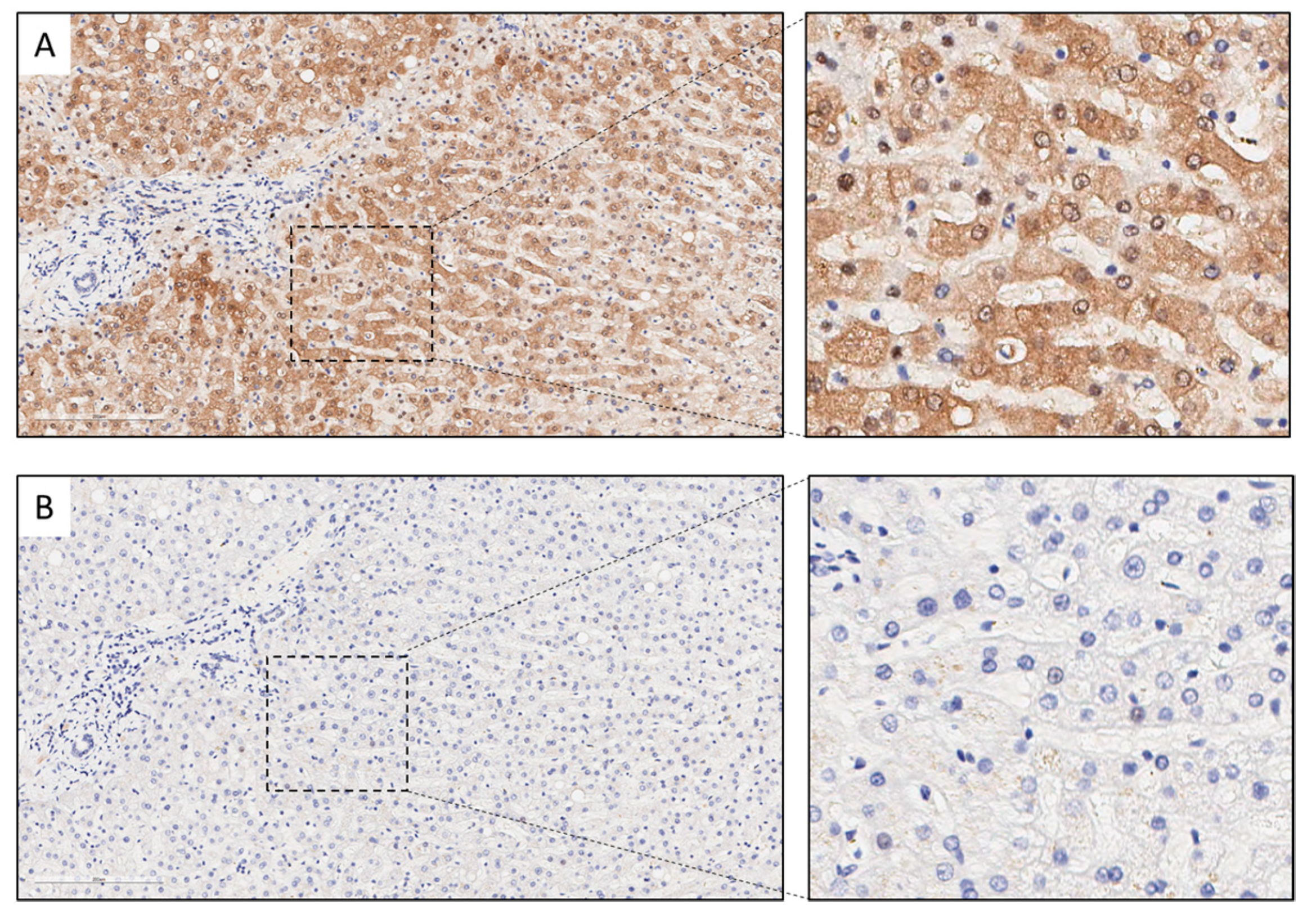 Cancers 14 02543 g0a5