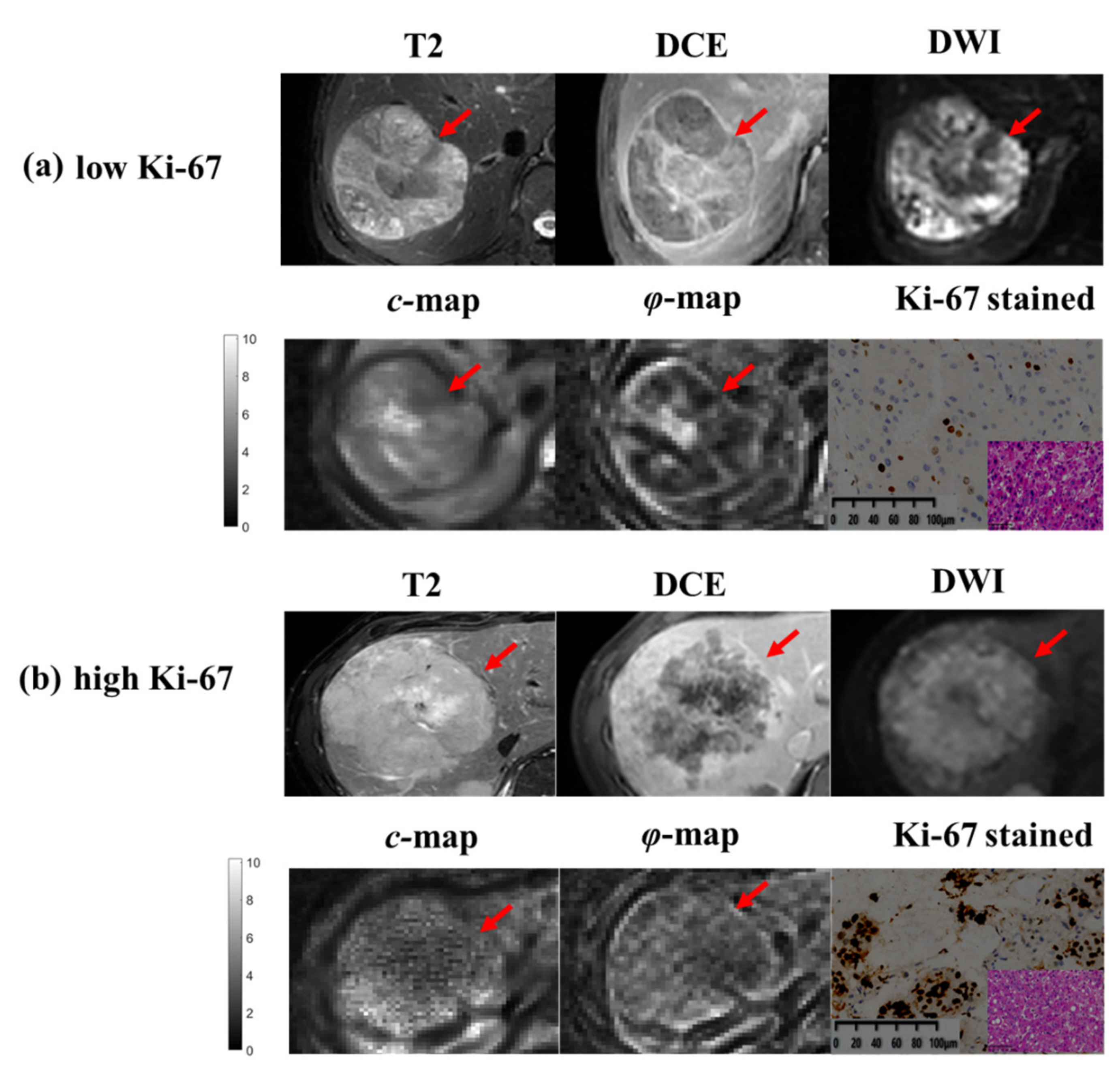 Cancers 14 02575 g004