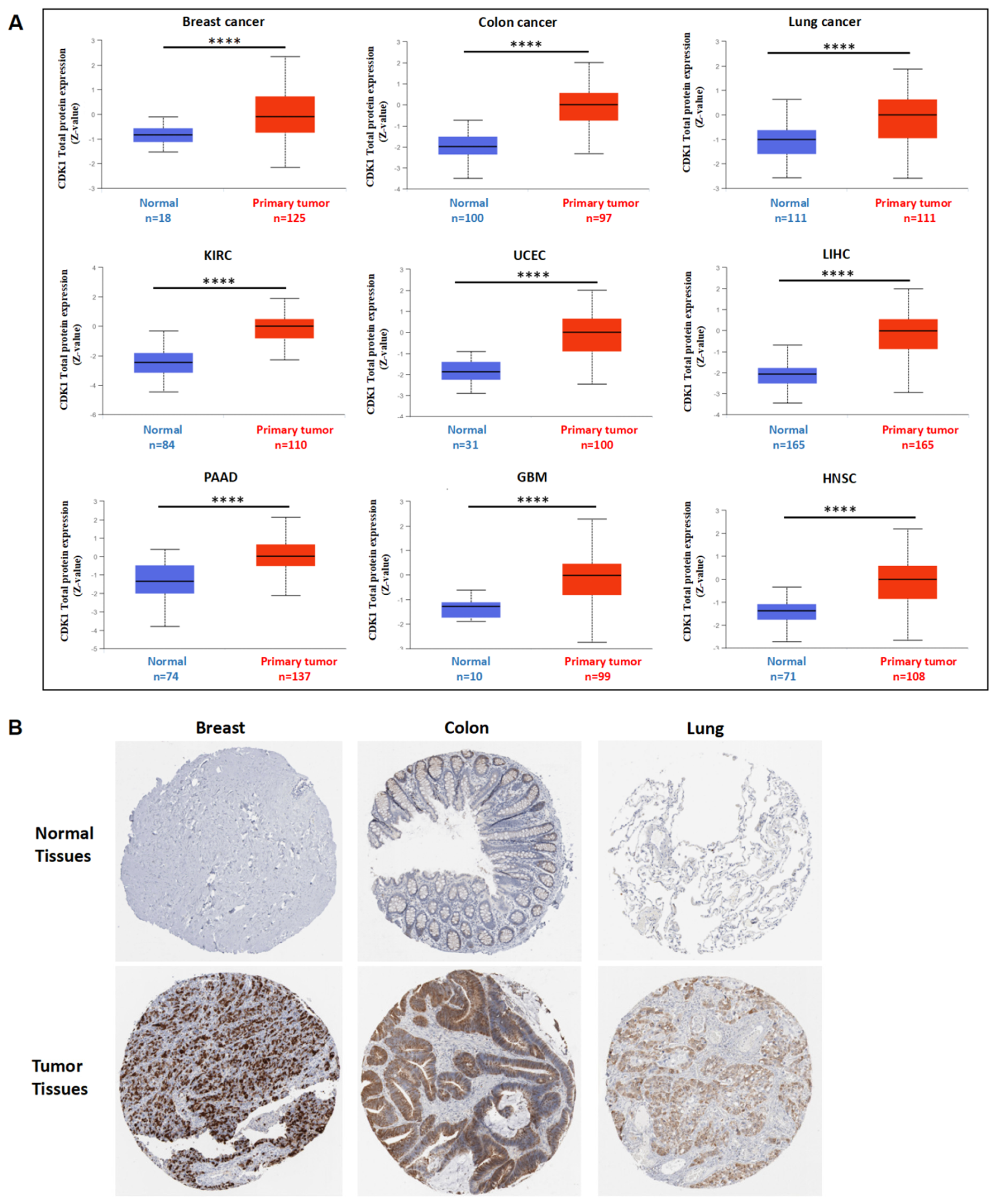 Cancers 14 02658 g003