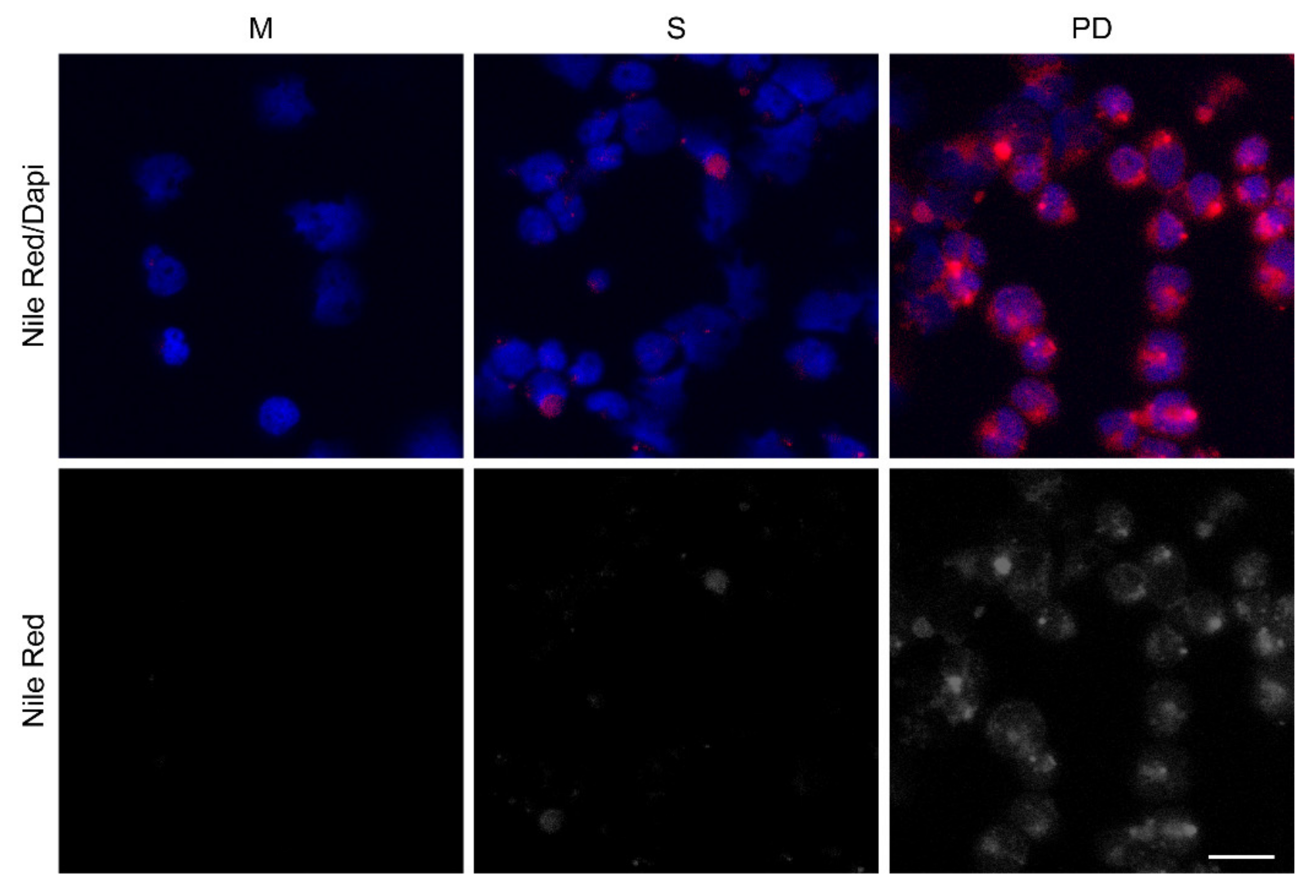 Cancers 14 02681 g003 Cancers 14 02681 g003