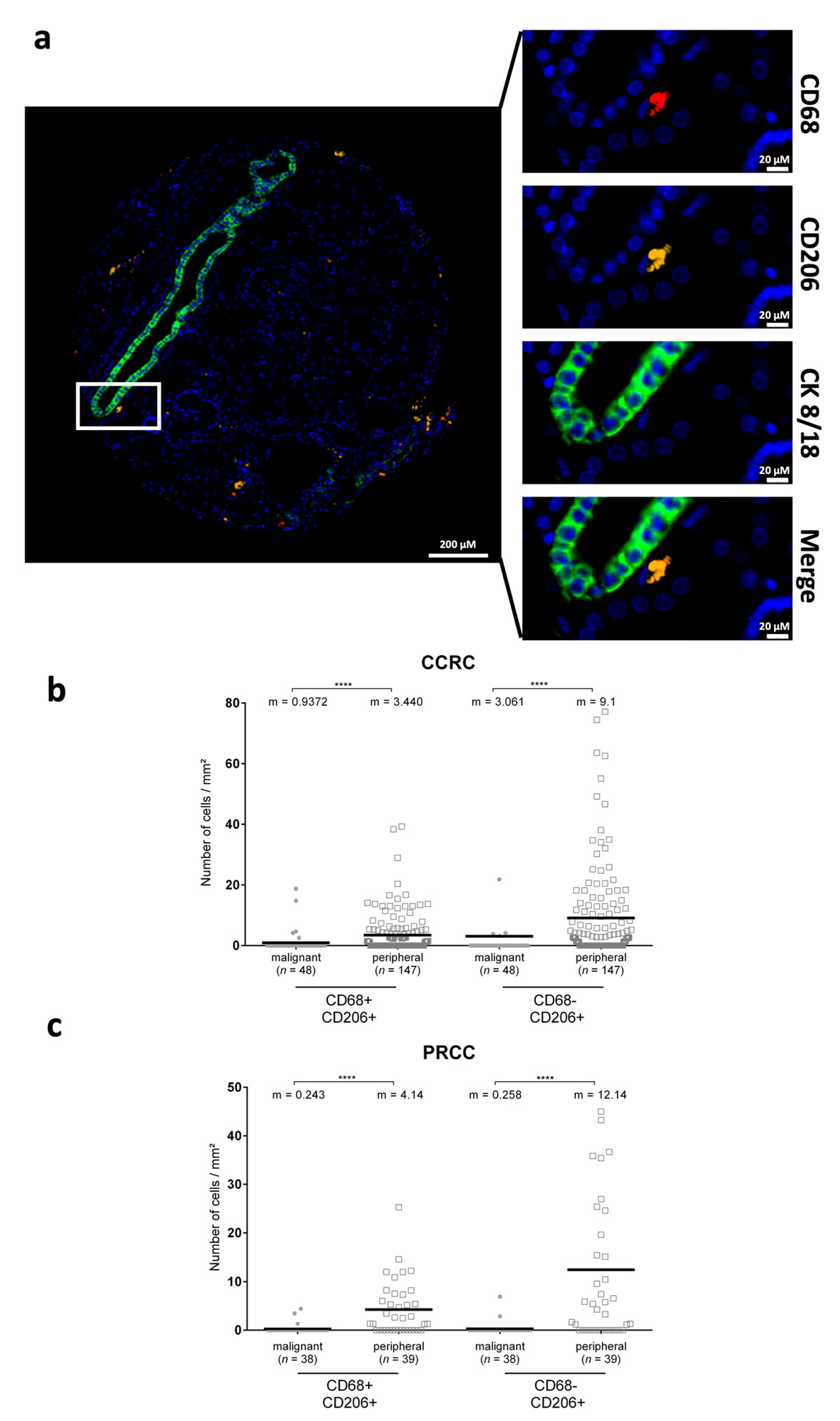 Cancers 14 02790 g004