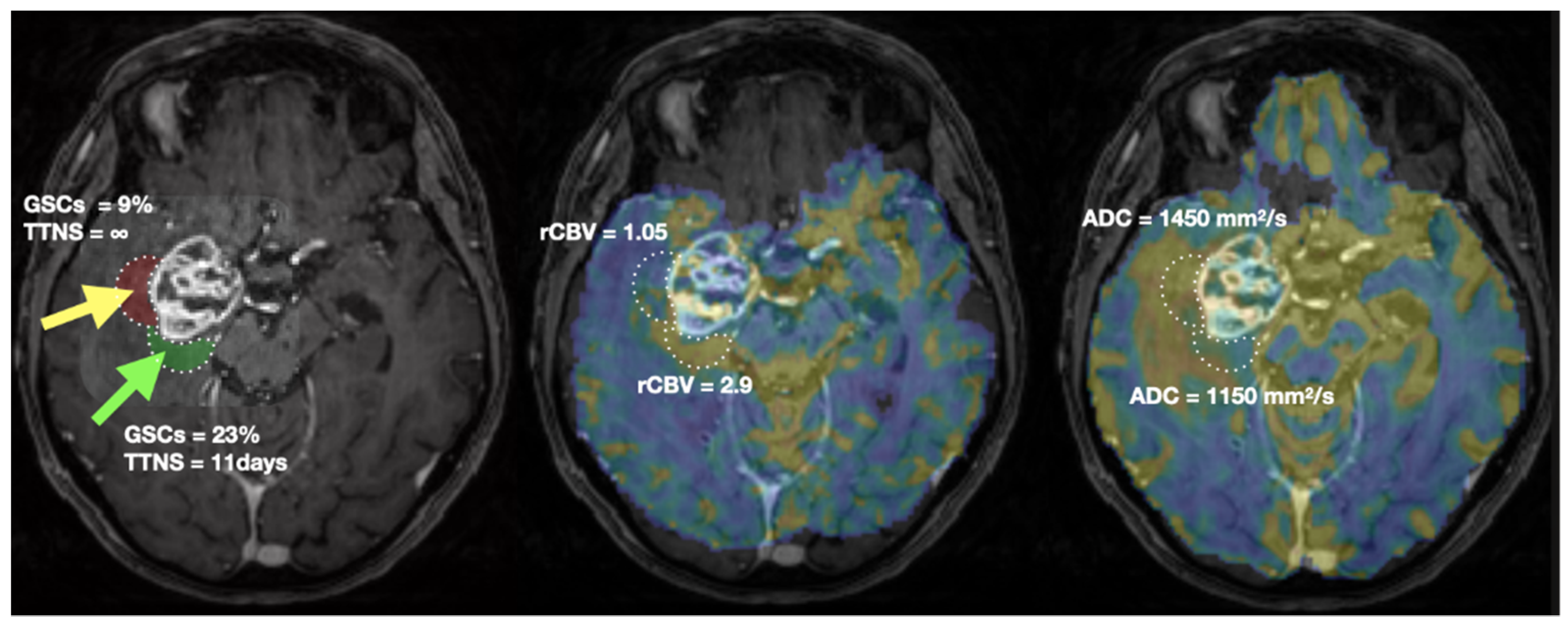 Cancers 14 02803 g005