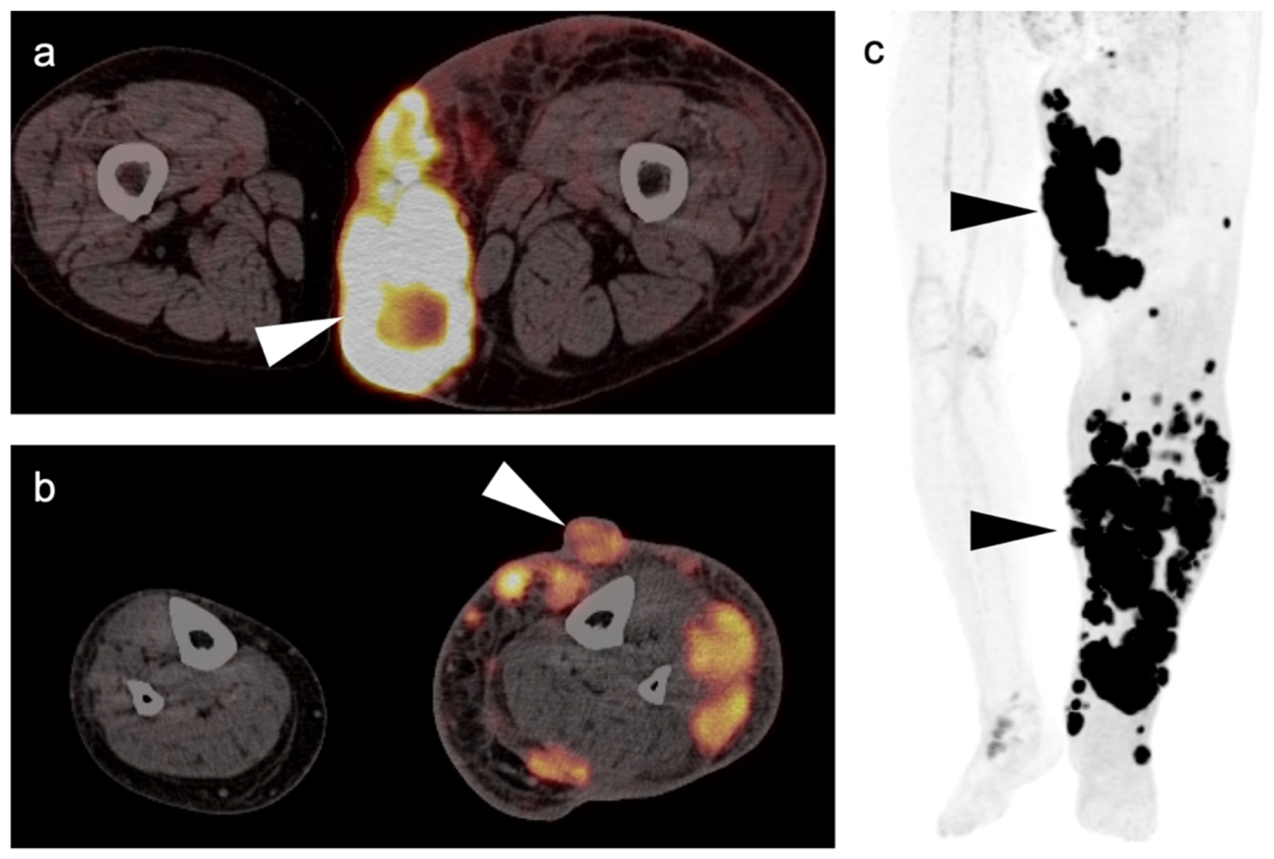 Cancers 14 02835 g003