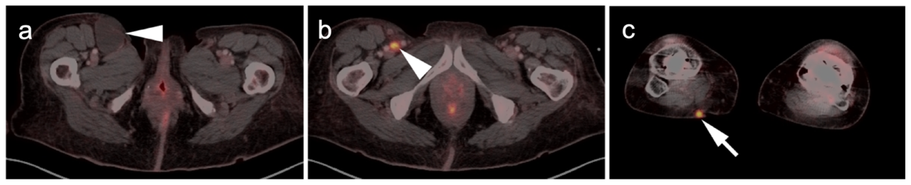 Cancers 14 02835 g004