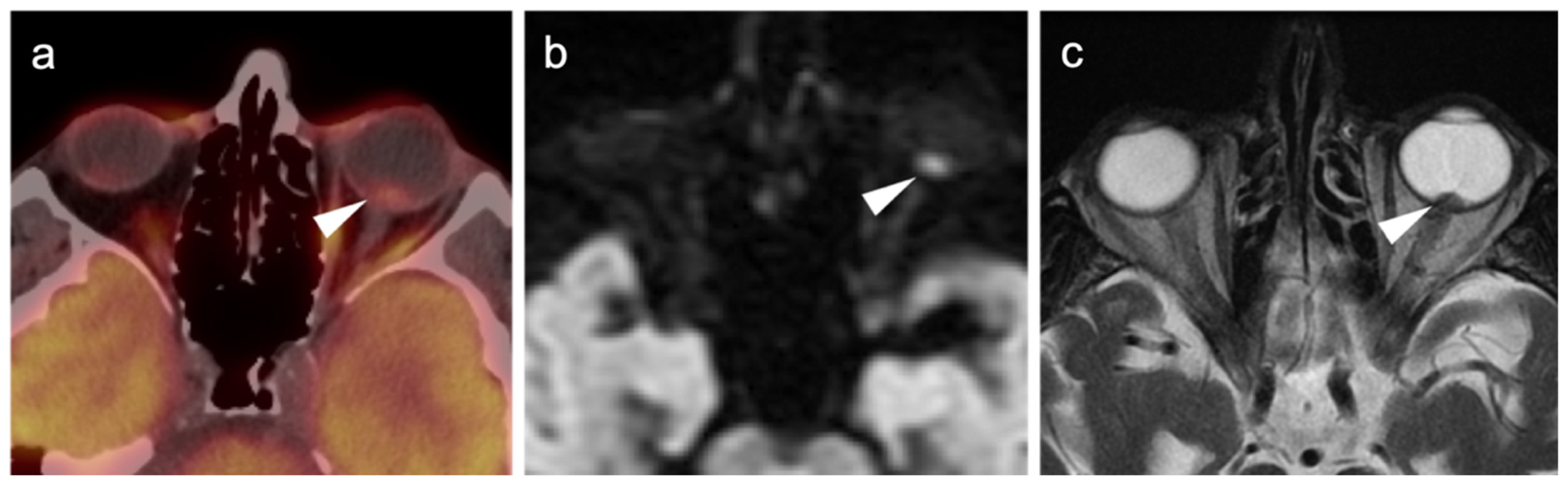 Cancers 14 02835 g005