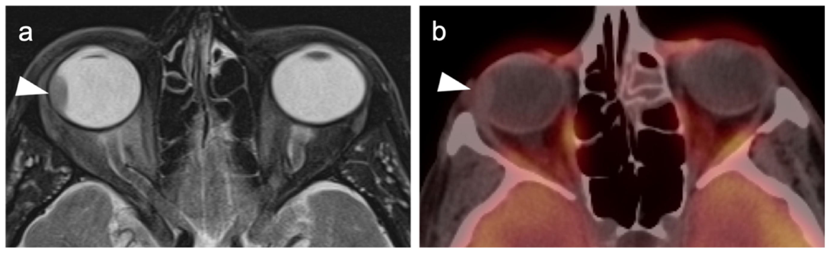 Cancers 14 02835 g006