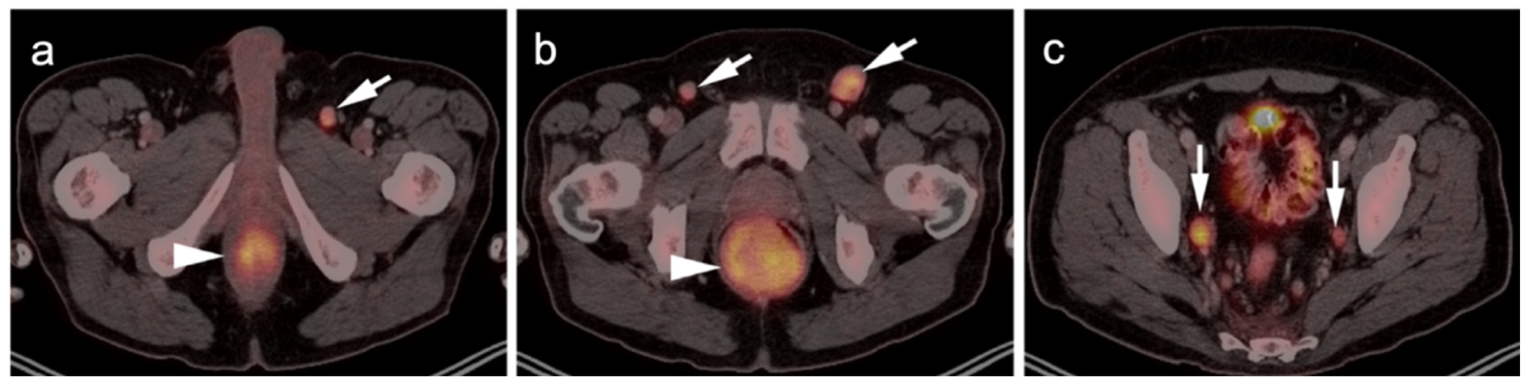 Cancers 14 02835 g007