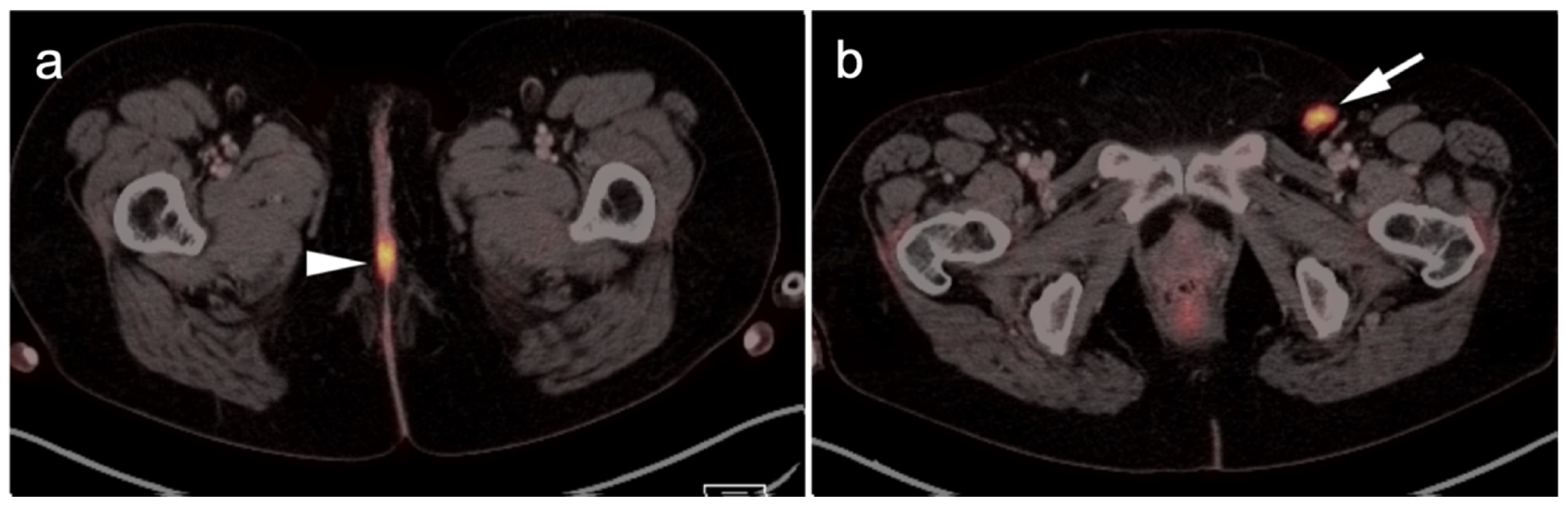 Cancers 14 02835 g008