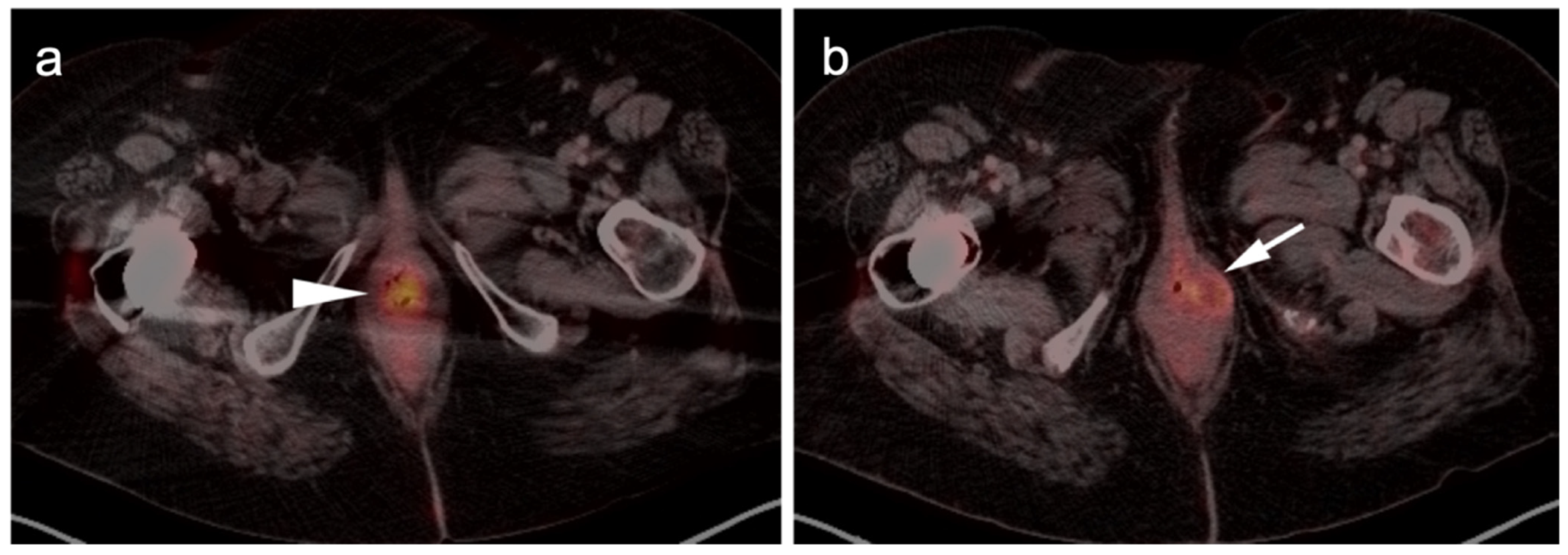 Cancers 14 02835 g009