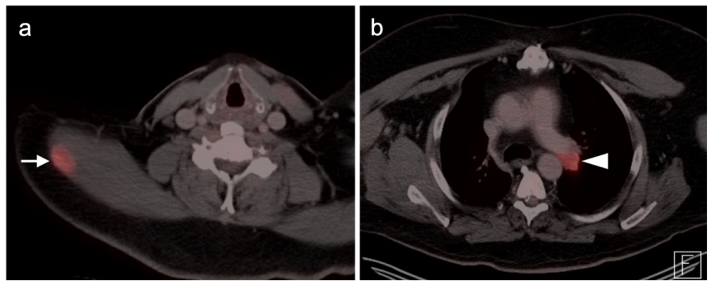 Cancers 14 02835 g015