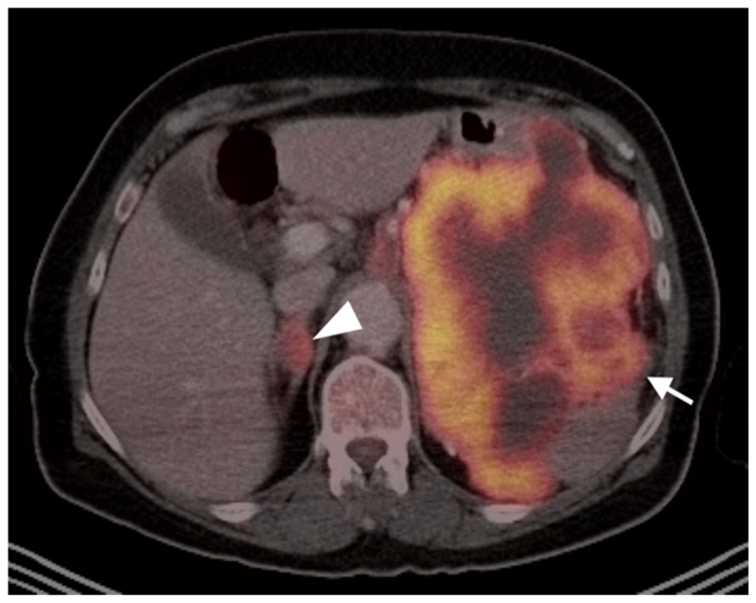 Cancers 14 02835 g017