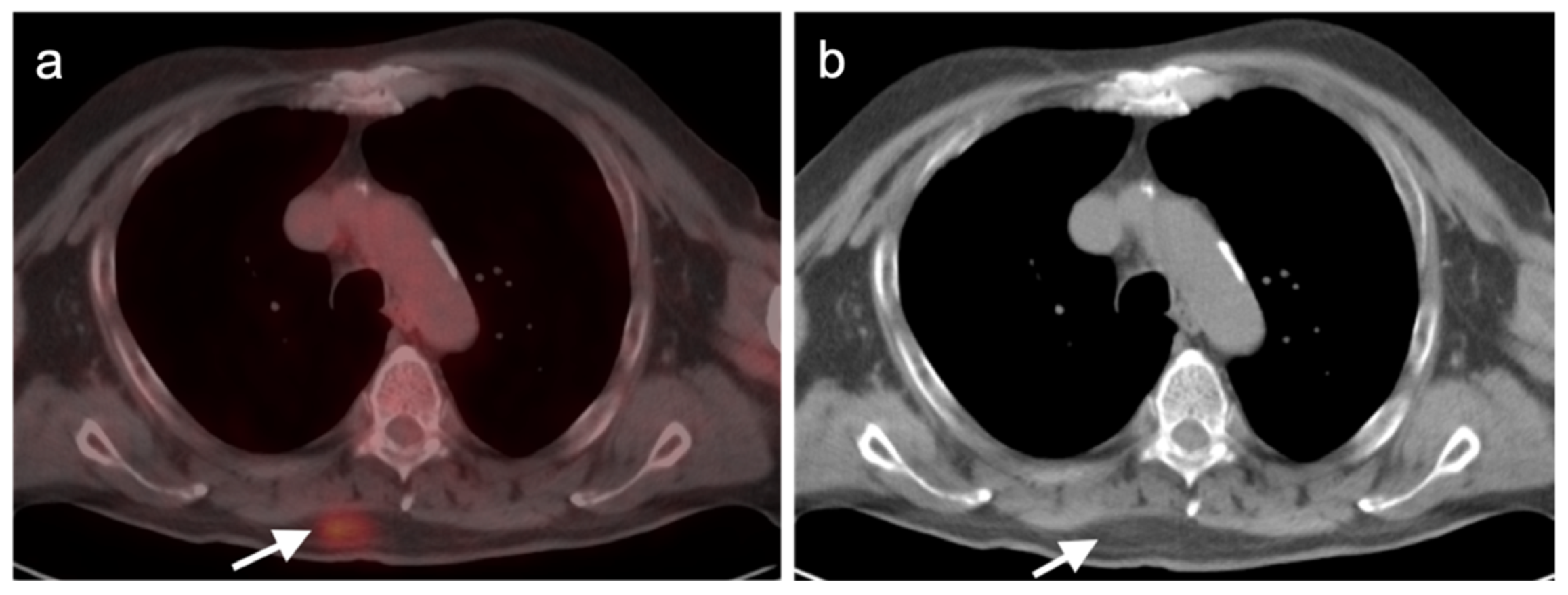 Cancers 14 02835 g021