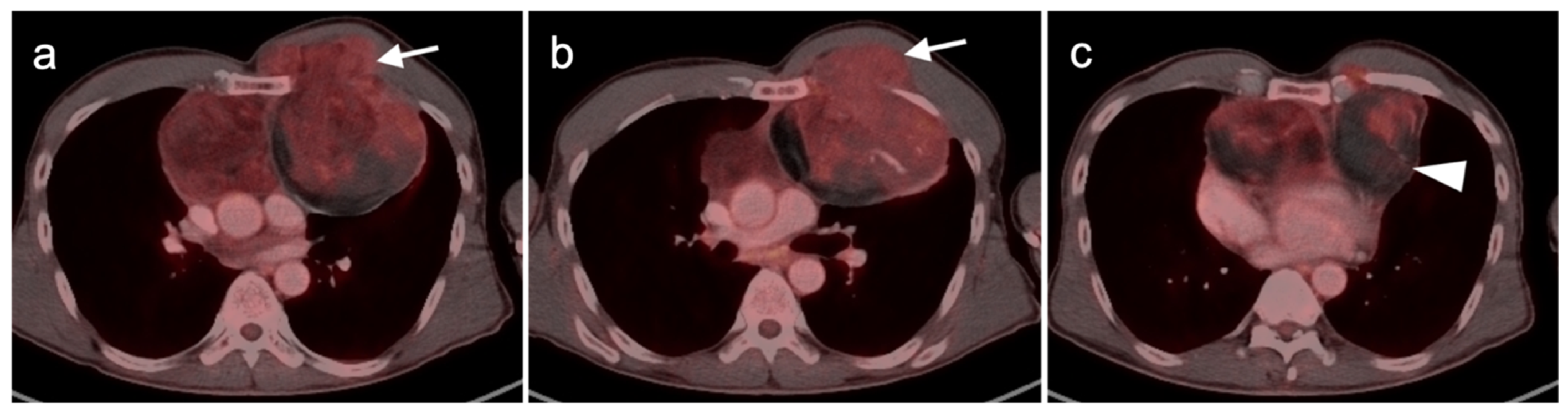 Cancers 14 02835 g023