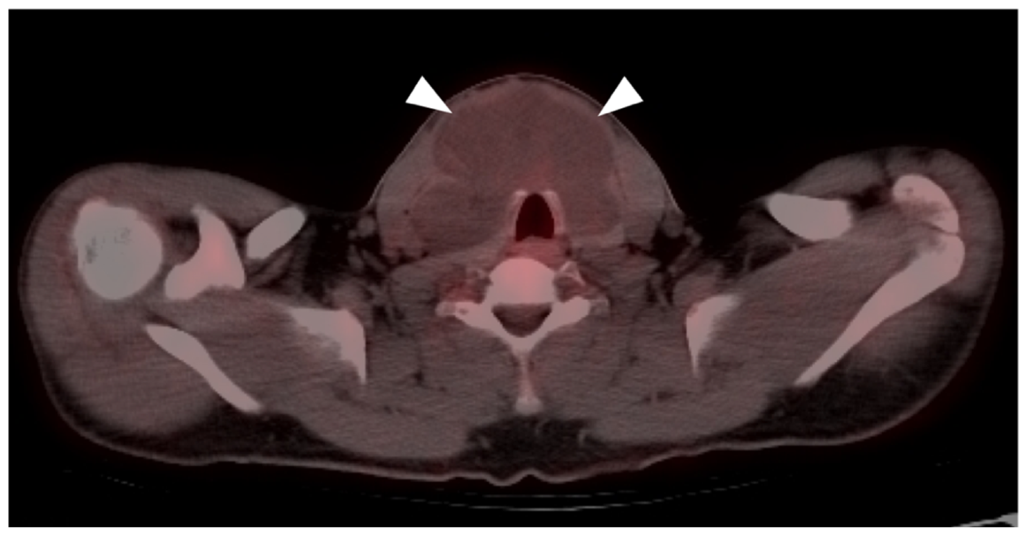 Cancers 14 02835 g024