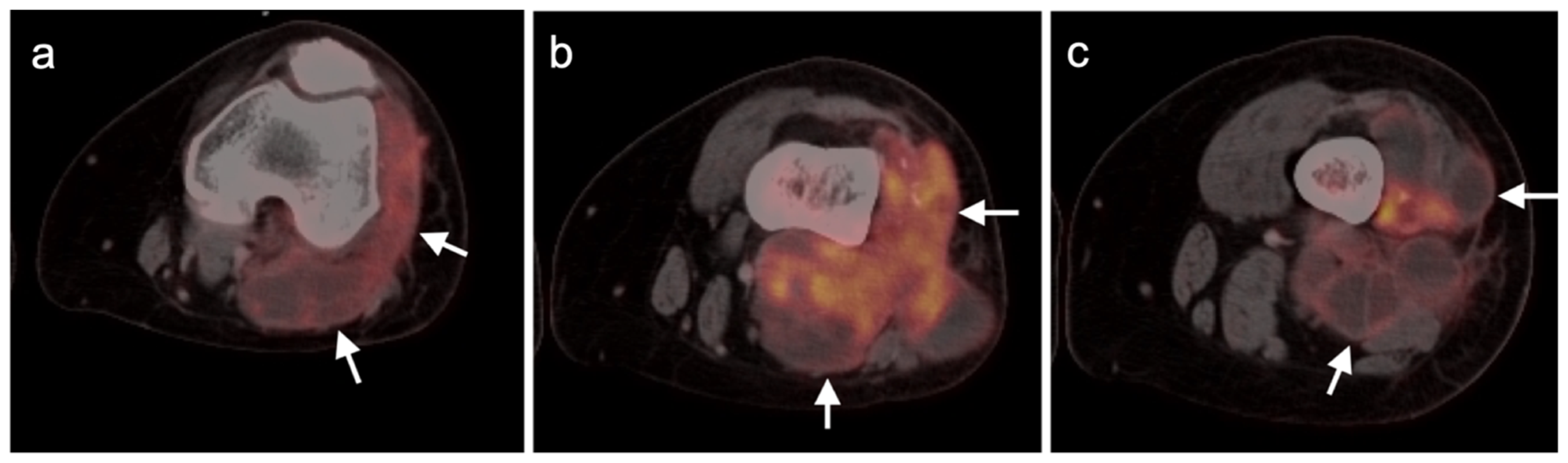 Cancers 14 02835 g025