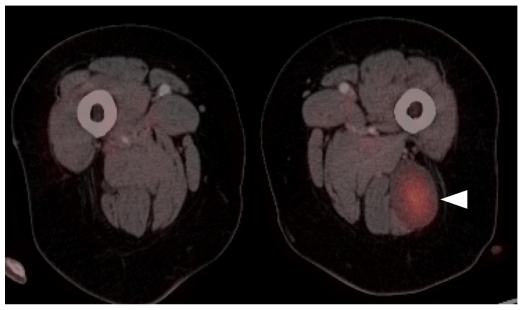 Cancers 14 02835 g028