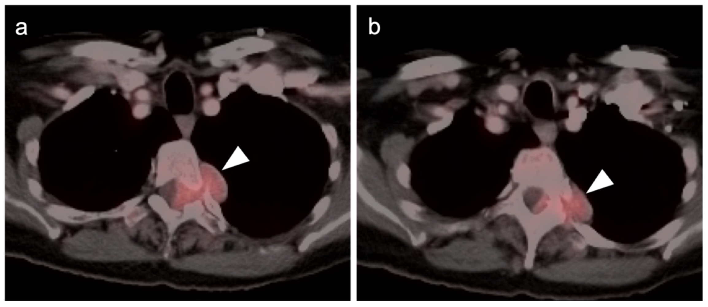 Cancers 14 02835 g030