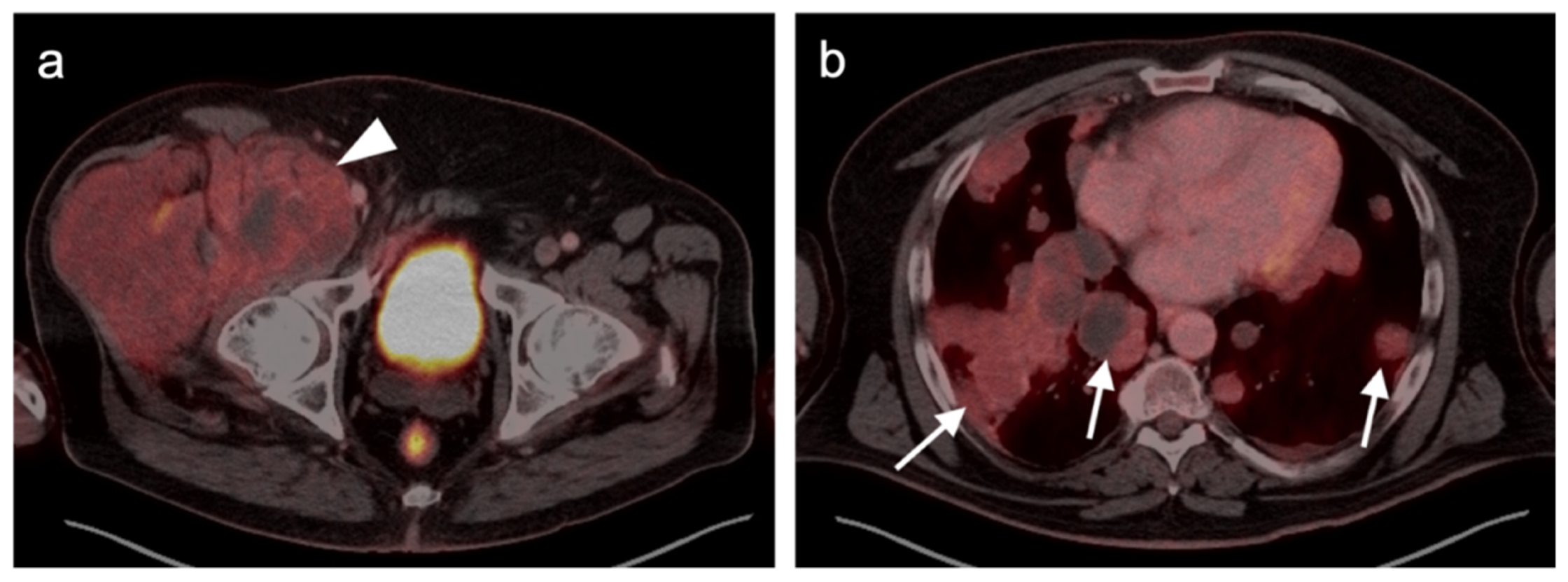 Cancers 14 02835 g031