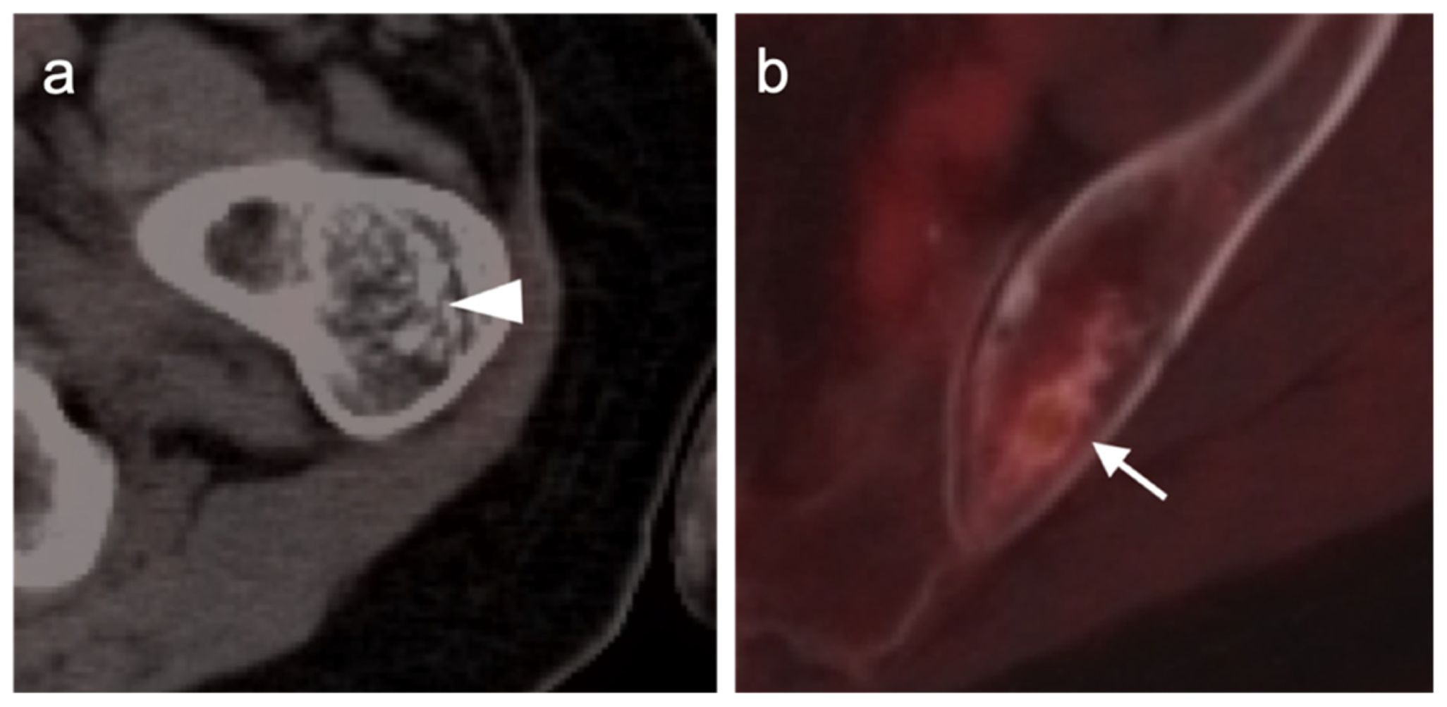 Cancers 14 02835 g032