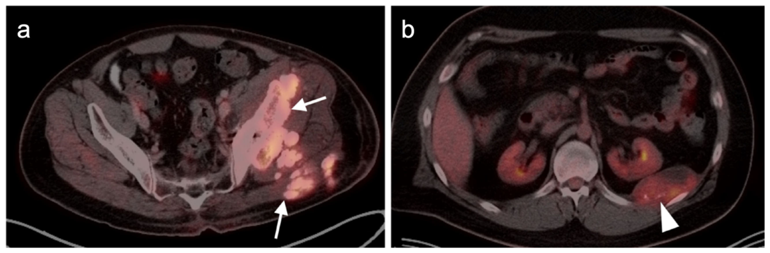 Cancers 14 02835 g033