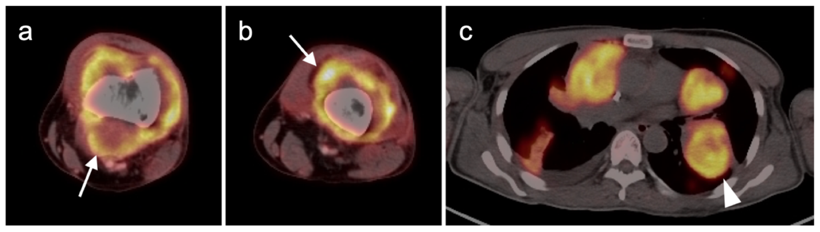 Cancers 14 02835 g034