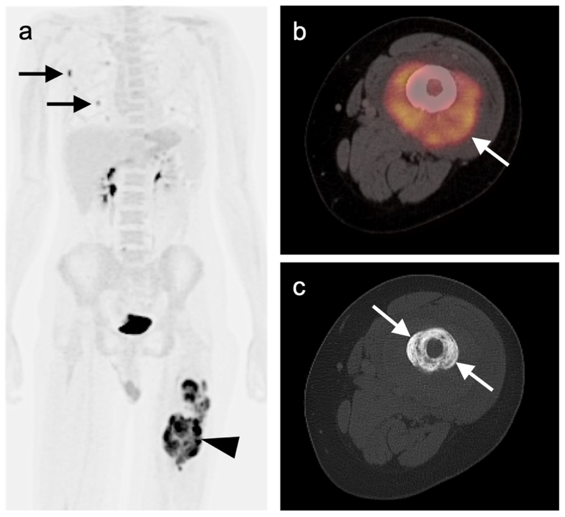 Cancers 14 02835 g035