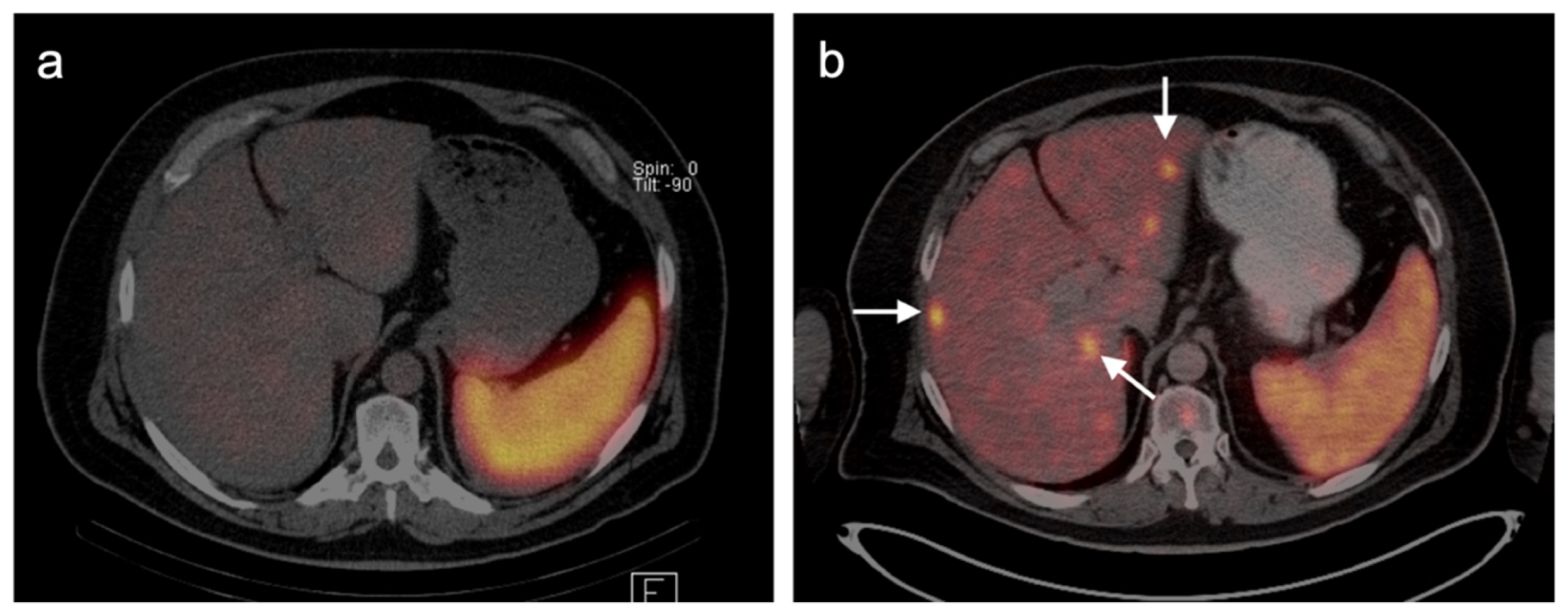 Cancers 14 02835 g036