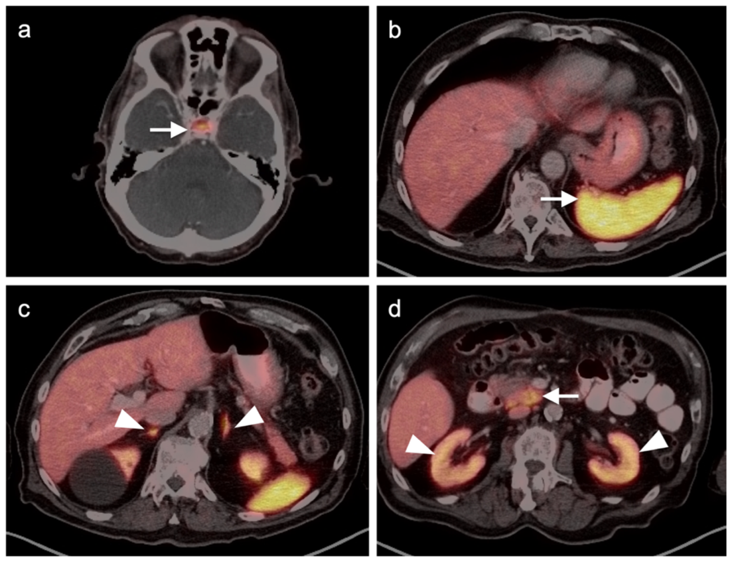 Cancers 14 02835 g037