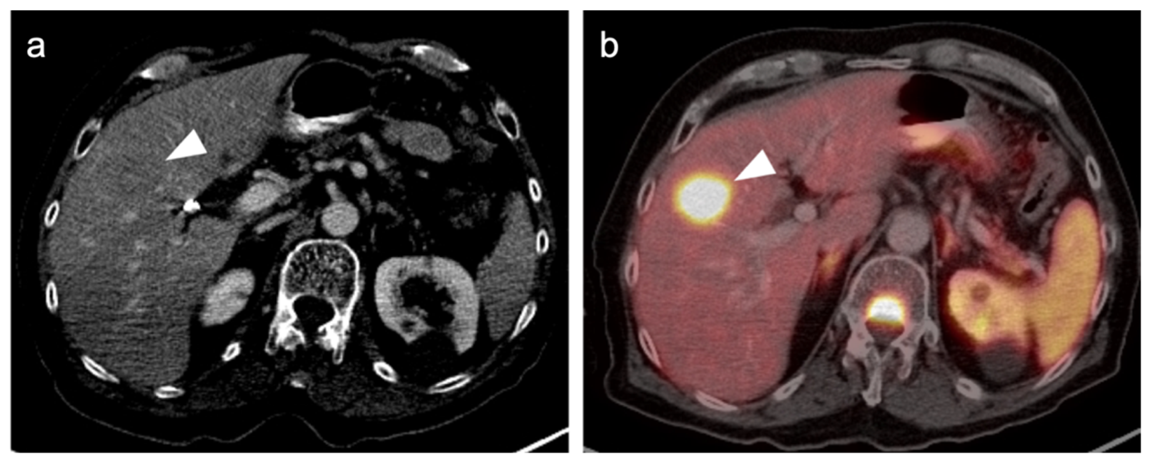 Cancers 14 02835 g038