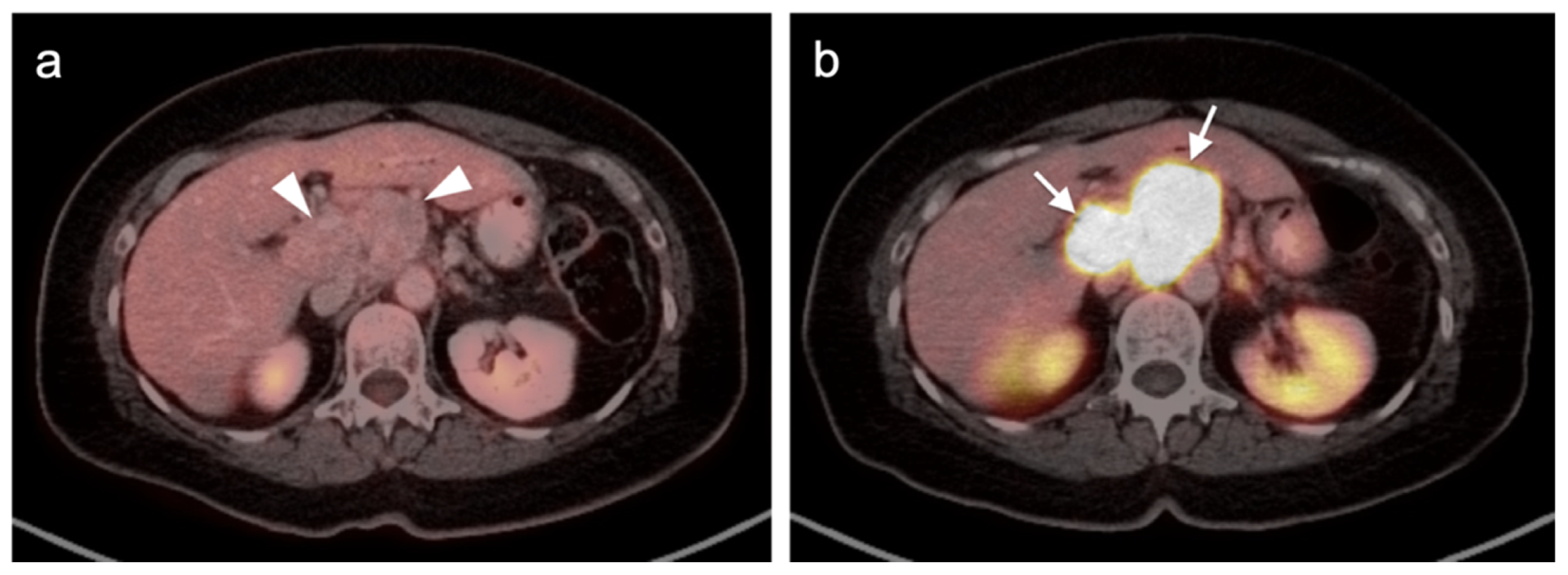 Cancers 14 02835 g040