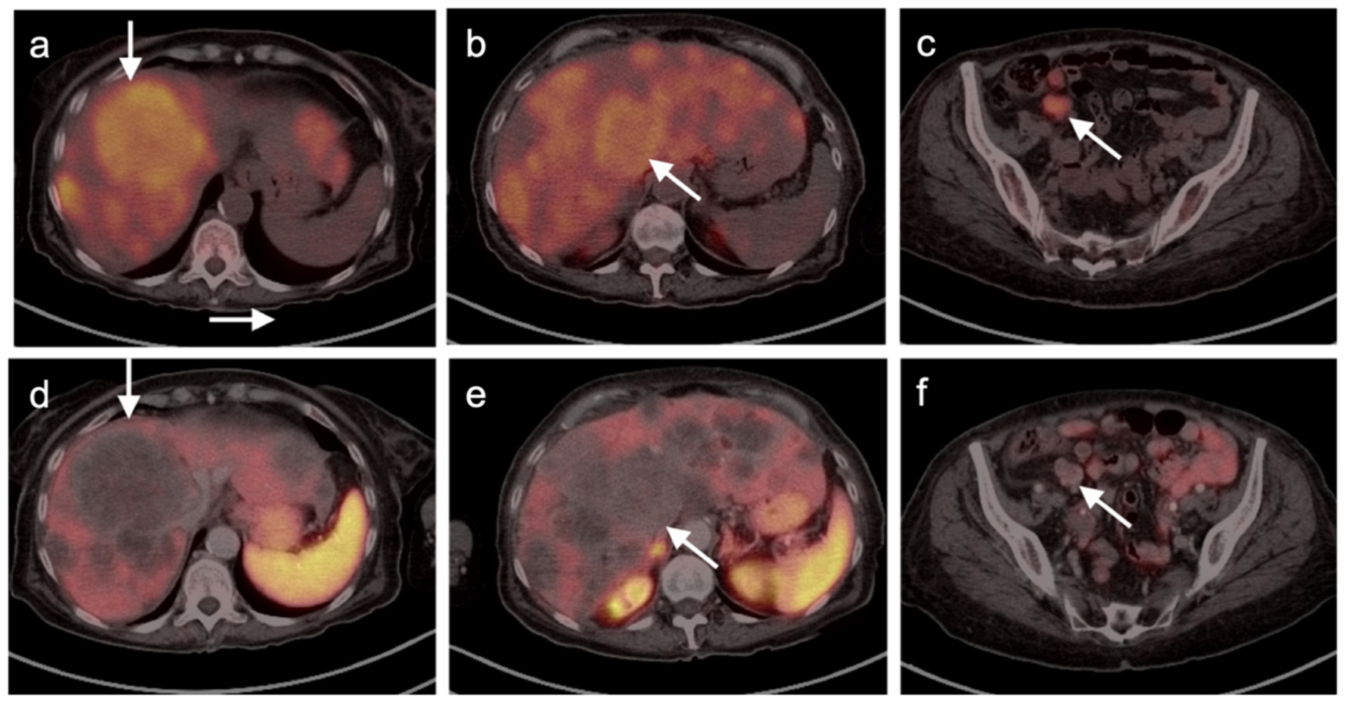 Cancers 14 02835 g041