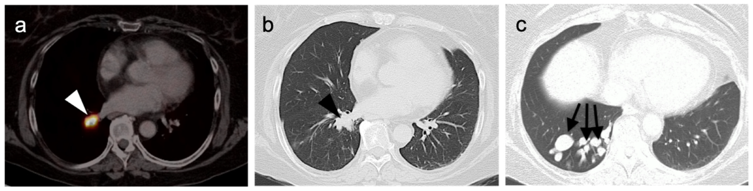 Cancers 14 02835 g042