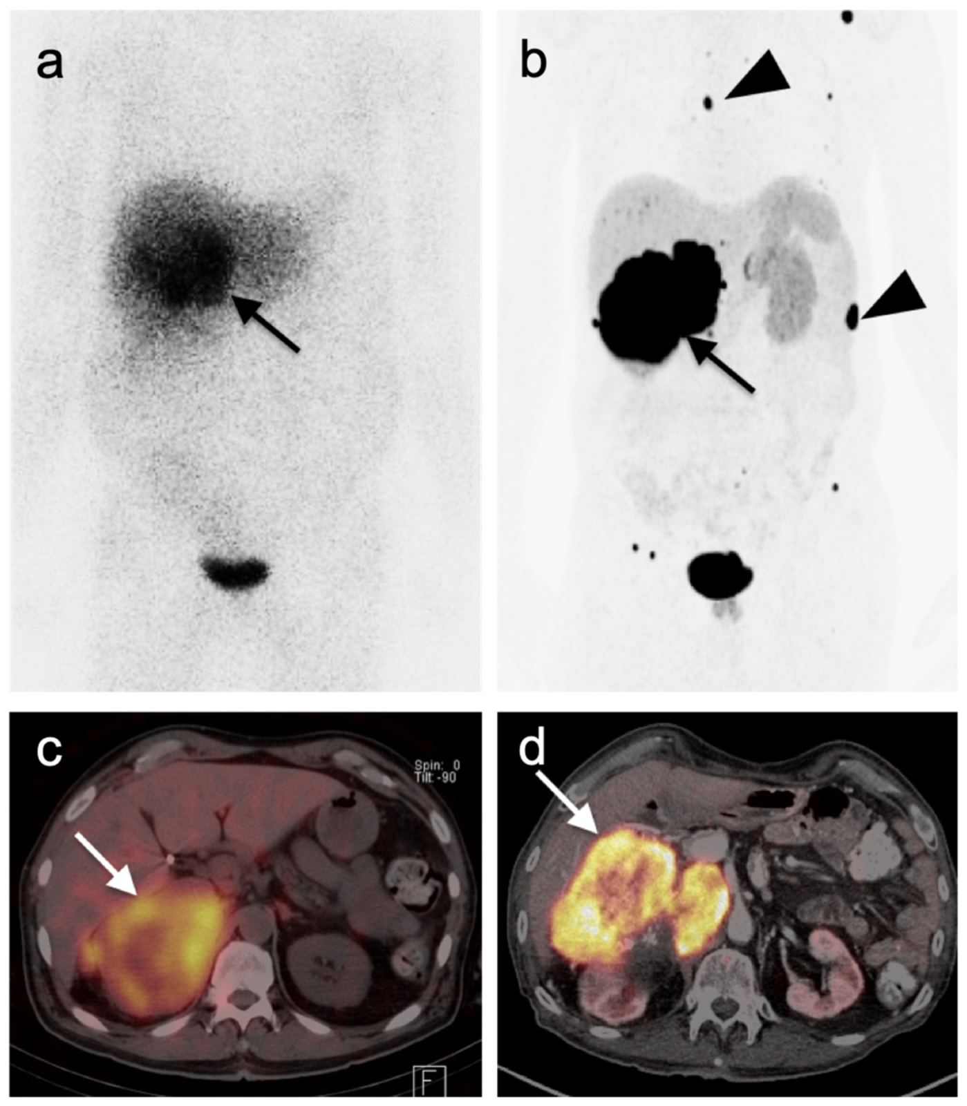 Cancers 14 02835 g043