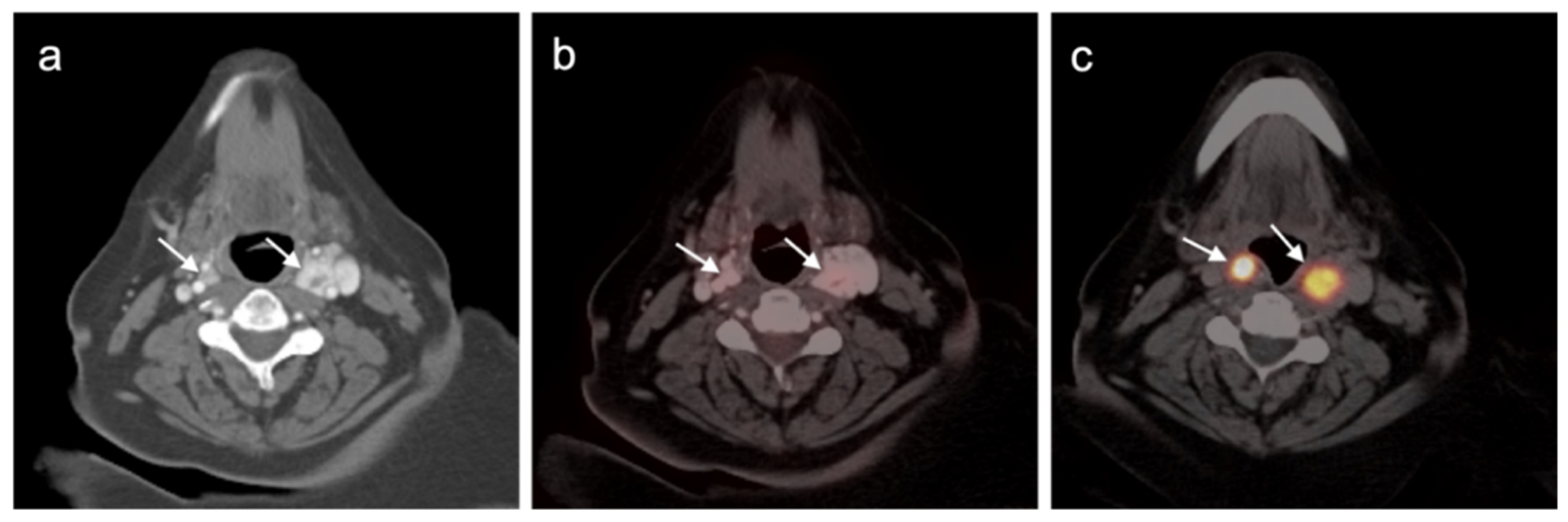 Cancers 14 02835 g044