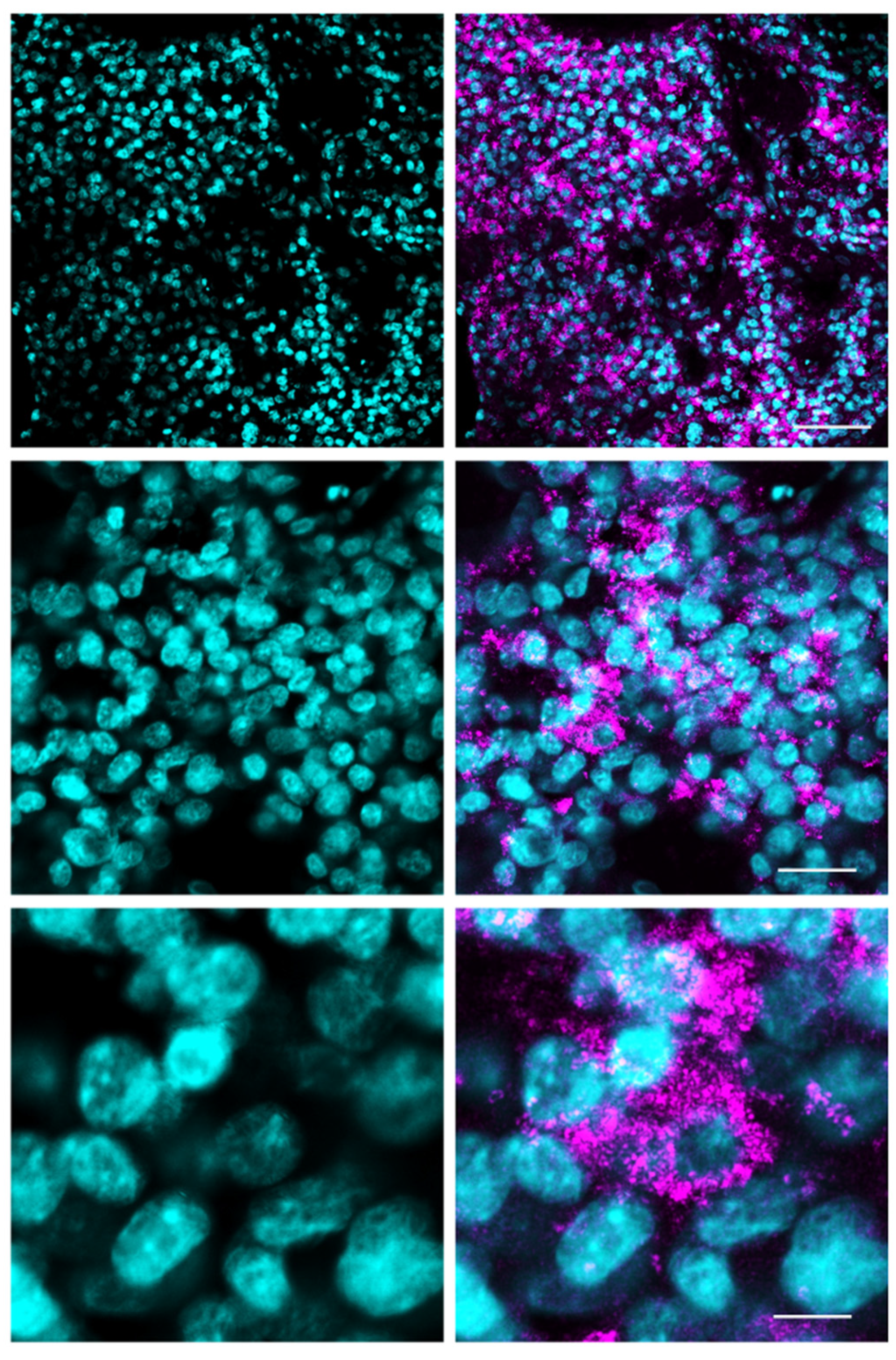 Cancers | Free Full-Text | 5-Aminolevulinic Acid (5-ALA)-Induced