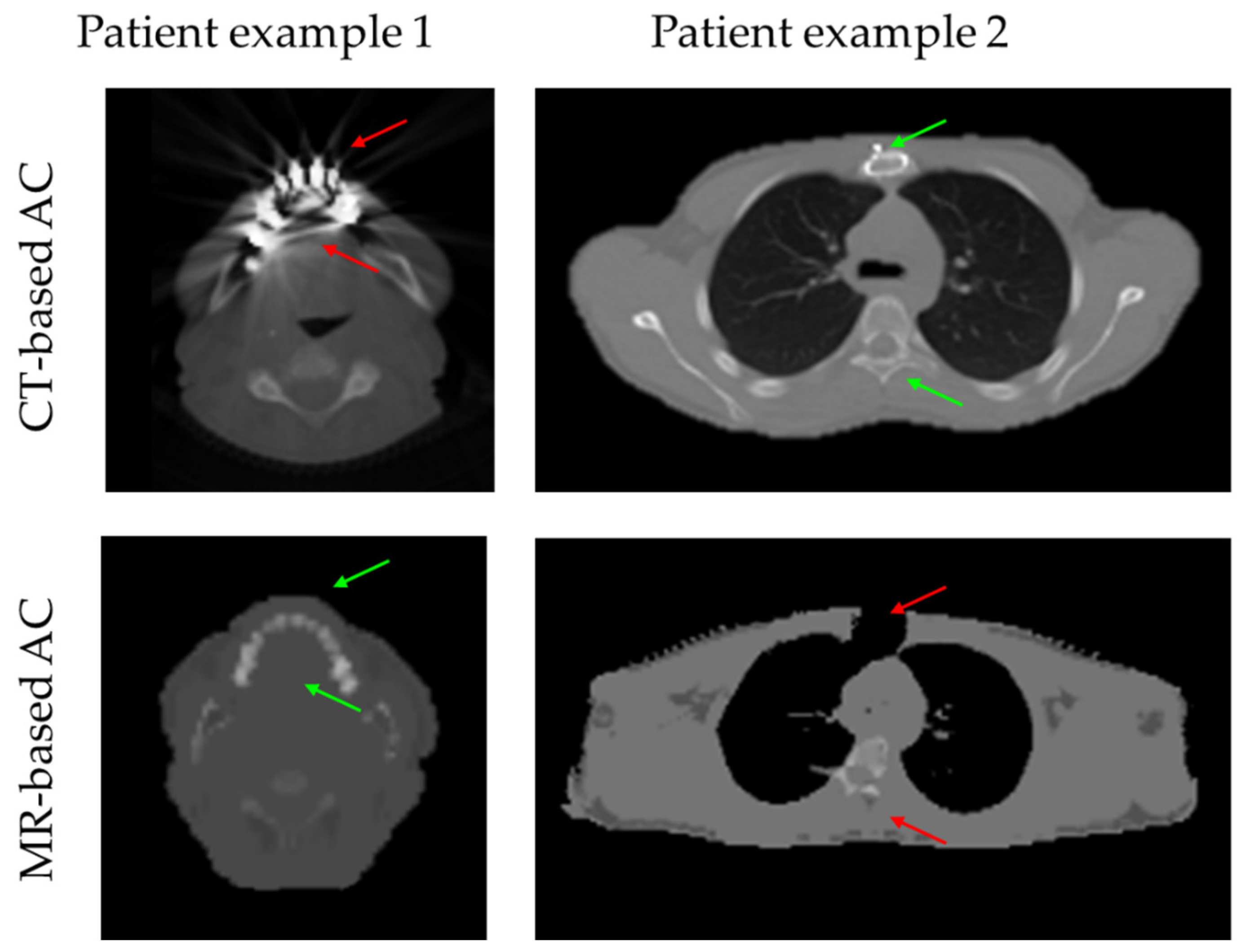 Cancers 14 03040 g004