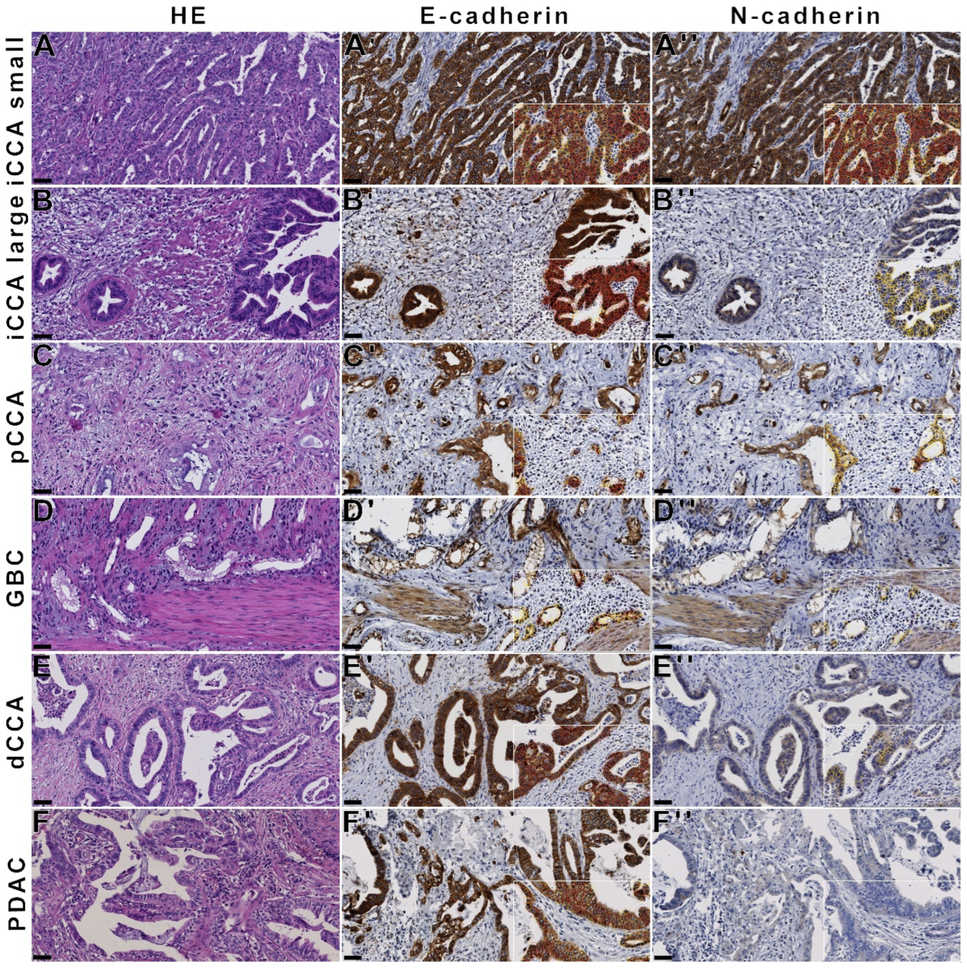 Cancers 14 03091 g004