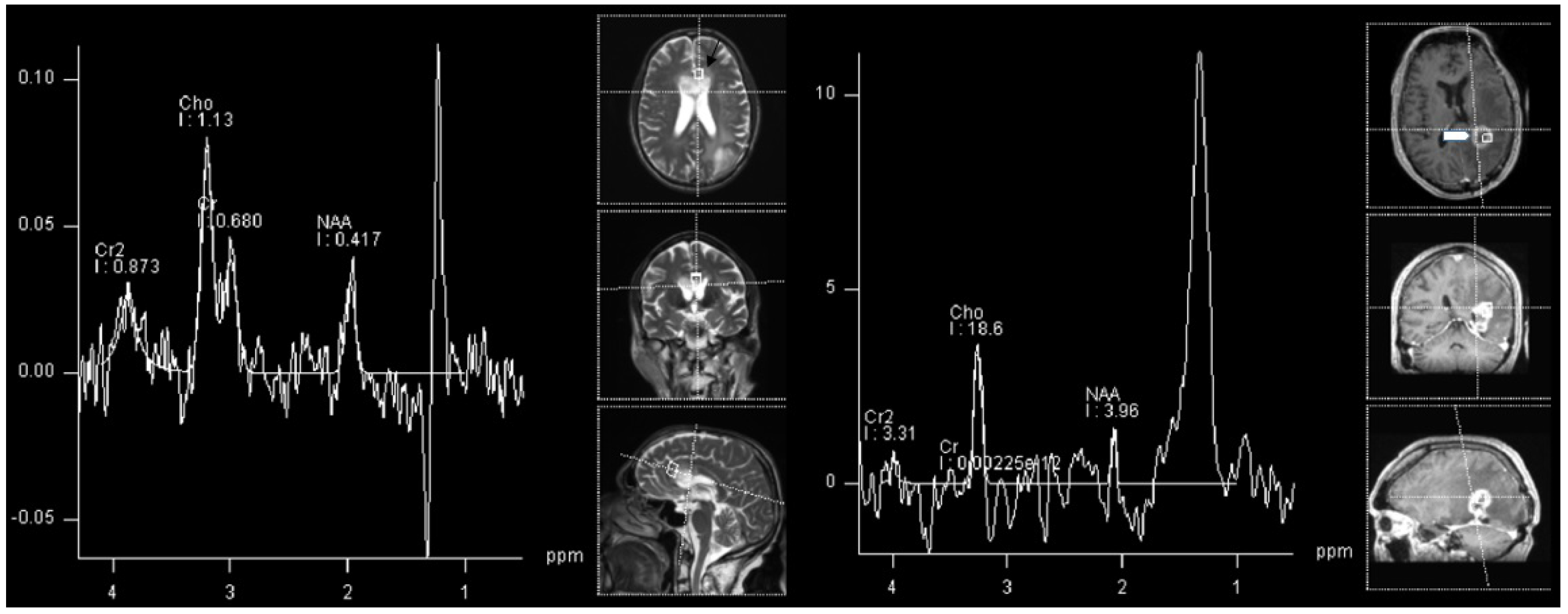 Cancers 14 03197 g004 Cancers 14 03197 g004