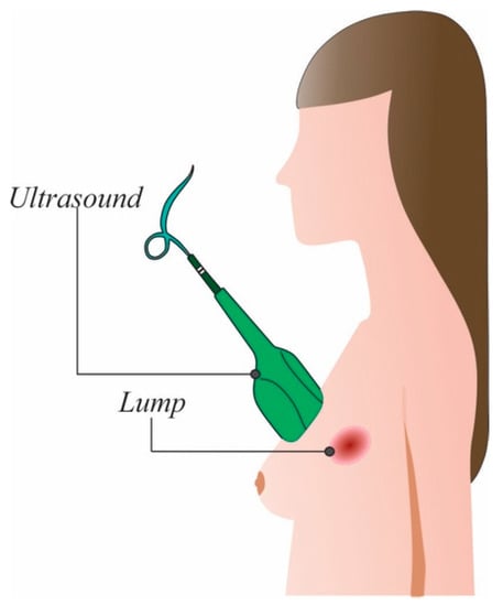 Breast cancer evaluation by fluorescent dot detection using combined  mathematical morphology and multifractal techniques, Diagnostic Pathology