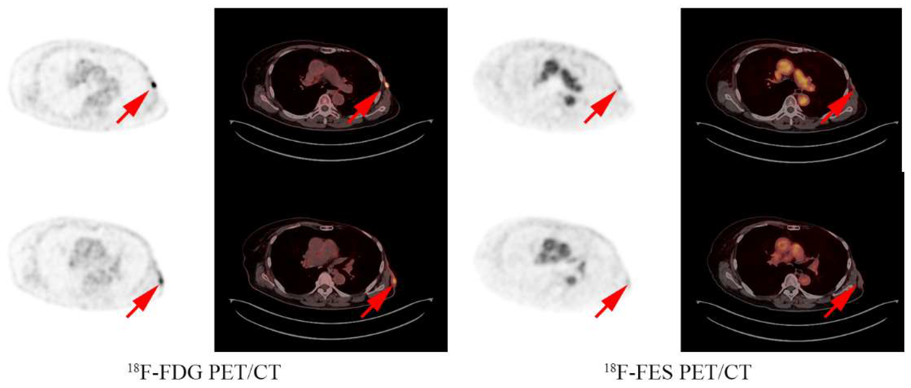 Cancers 14 03531 g003 Cancers 14 03531 g003