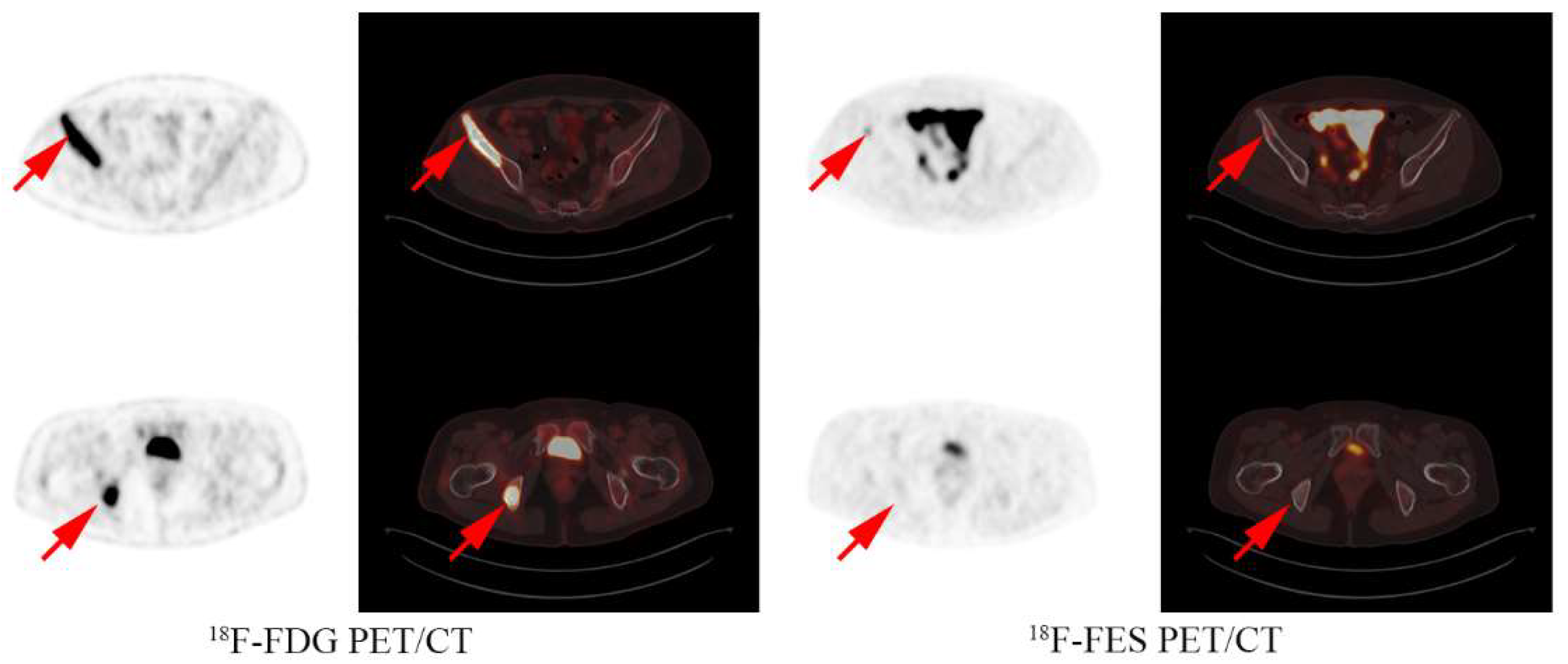 Cancers 14 03531 g004 Cancers 14 03531 g004