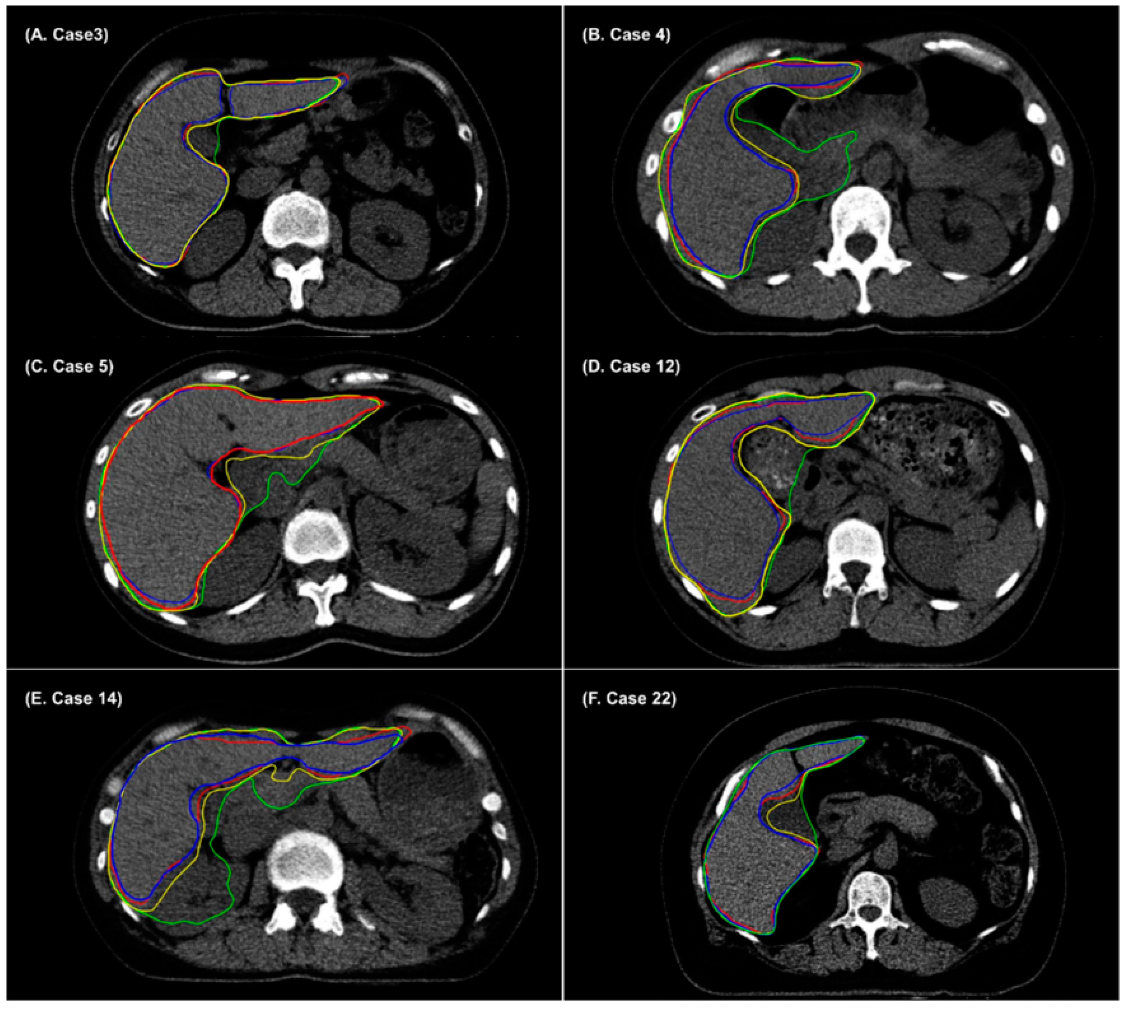 Cancers 14 03581 g003