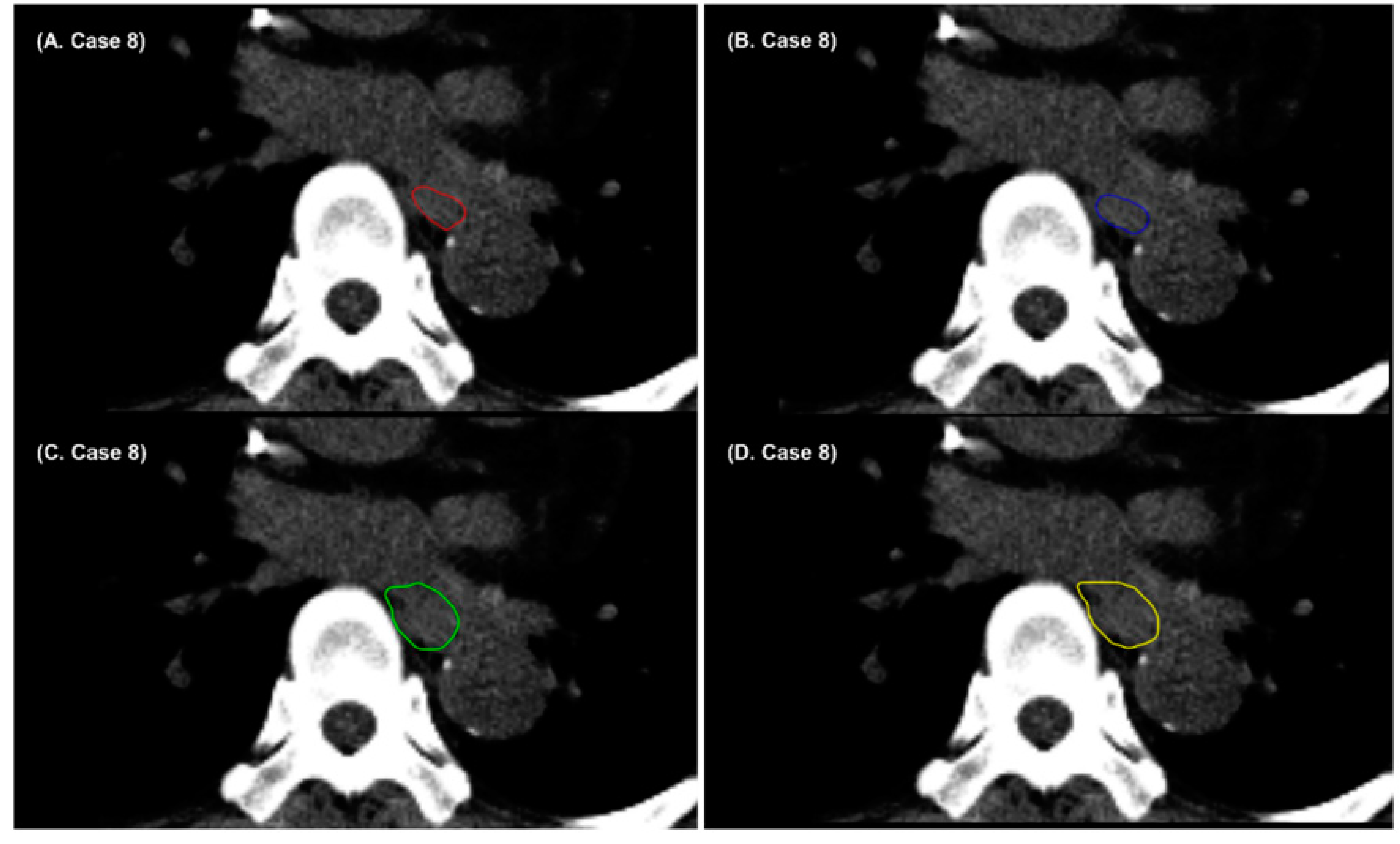 Cancers 14 03581 g004