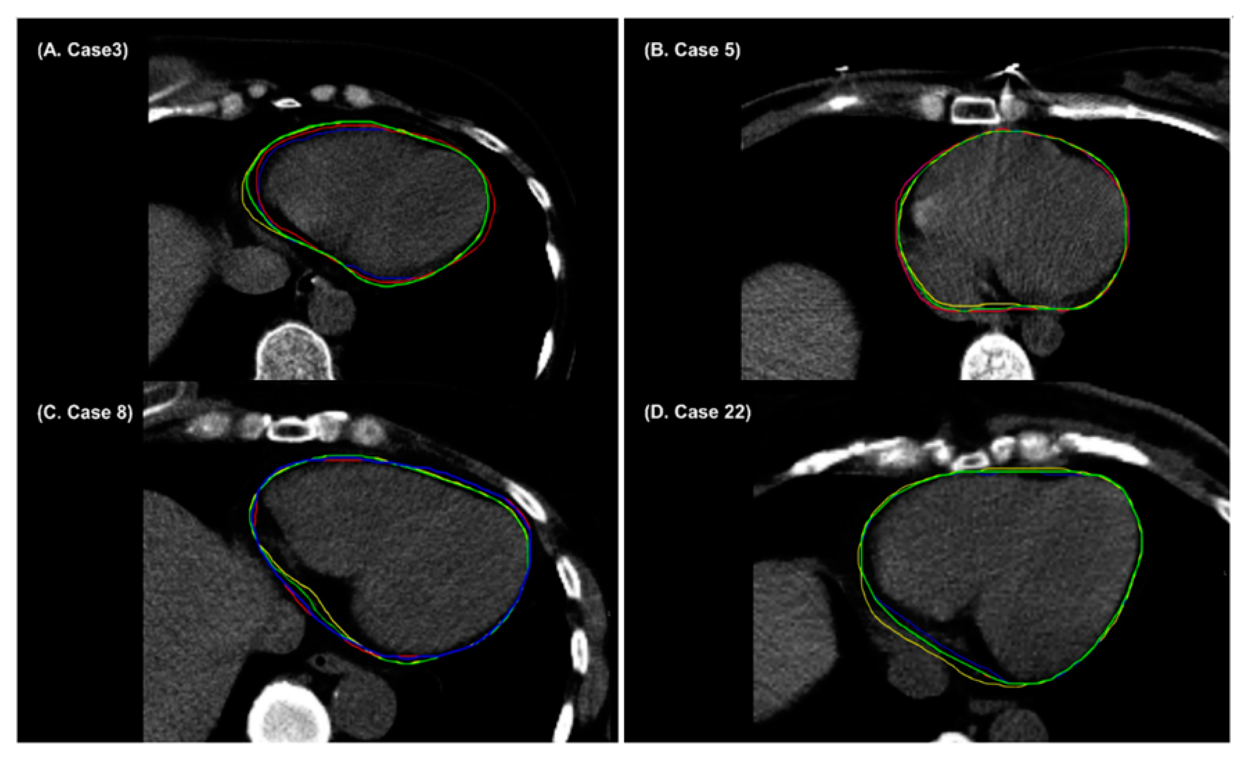 Cancers 14 03581 g006