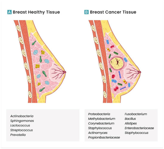 Meddy Bear - Female breast and Breast cancer.