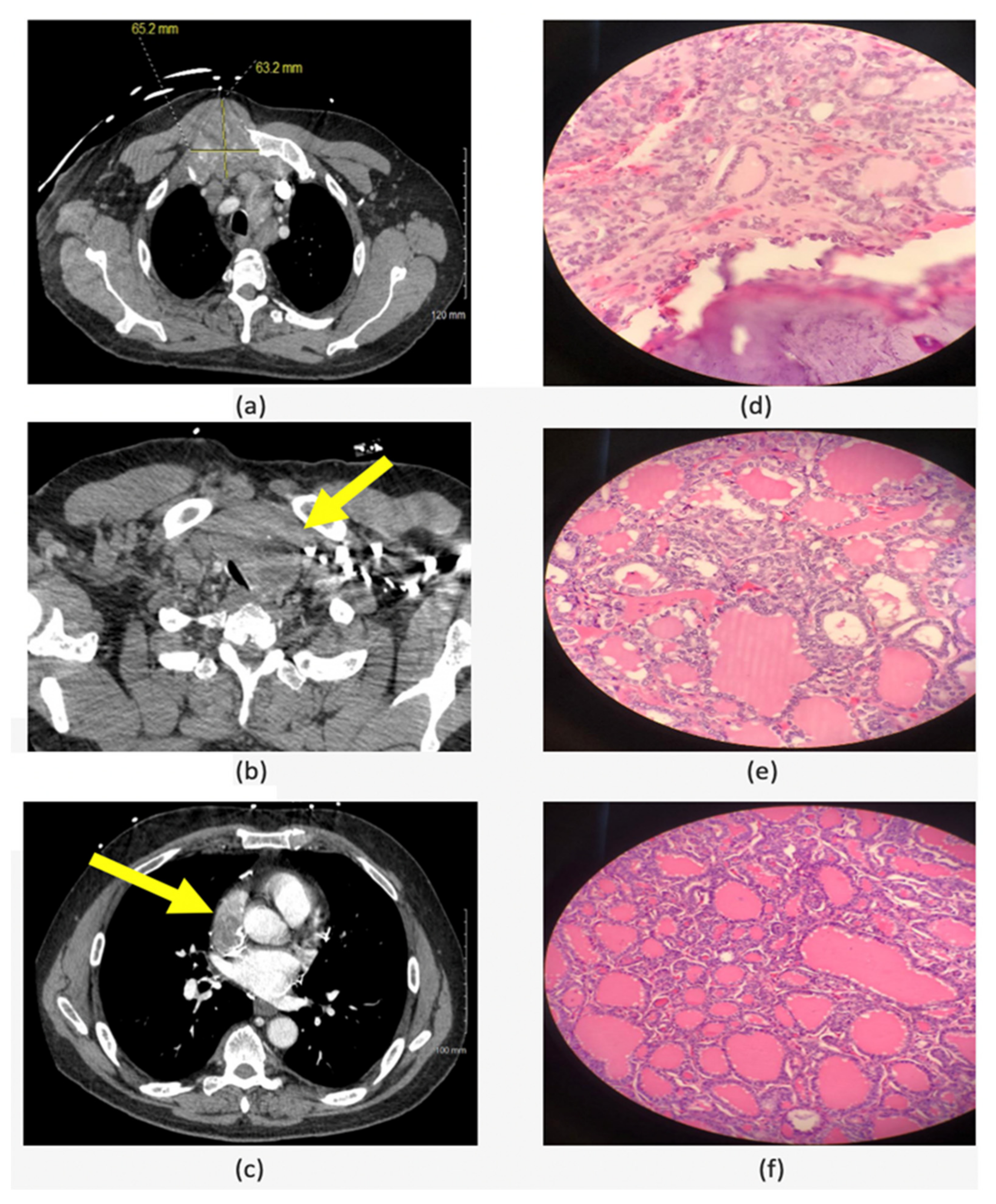 Cancers 14 04140 g003